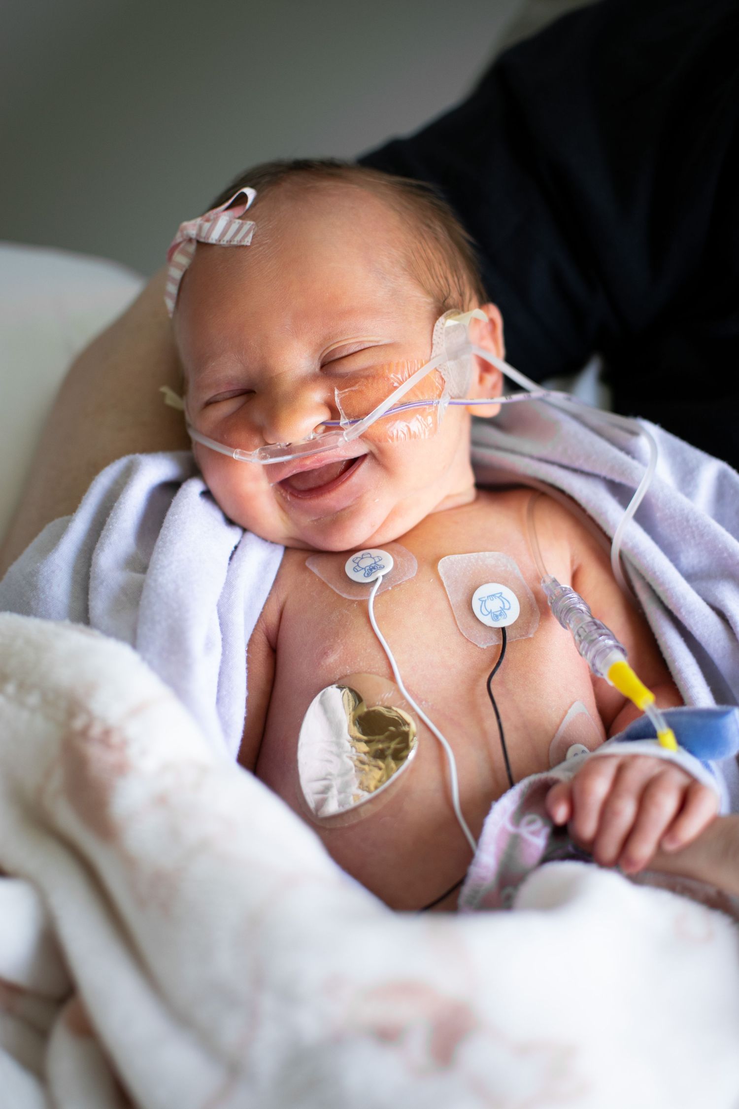 Premature newborn baby smiling with medical tubes and heart monitor sensors in hospital NICU ward.