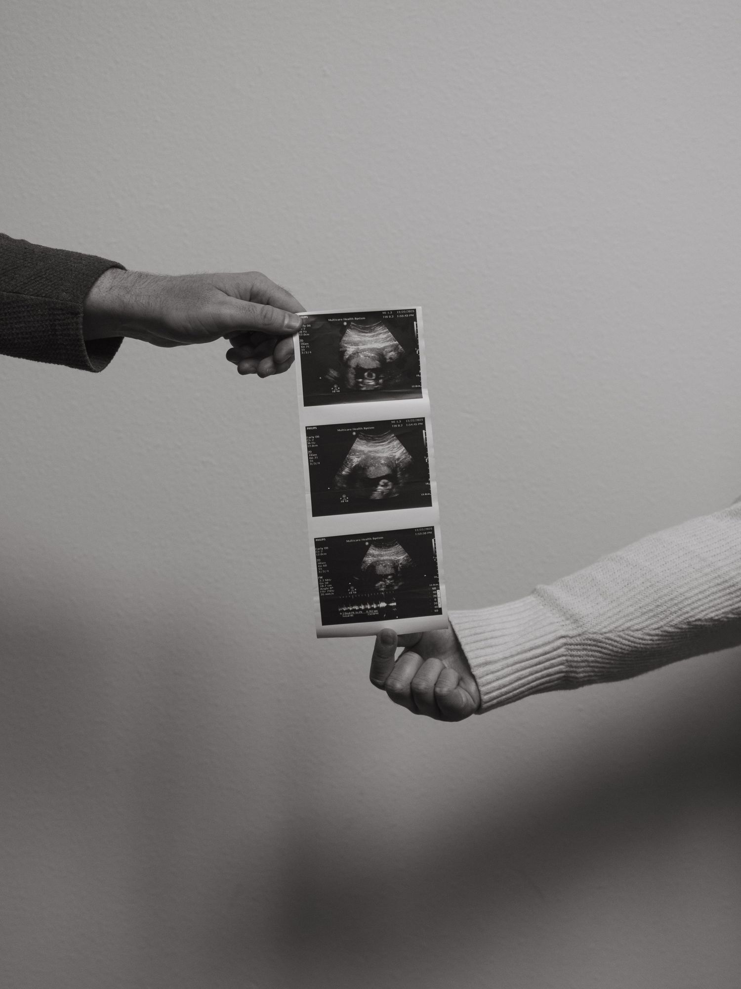 Two hands exchanging ultrasound photos in a minimalist black and white composition.