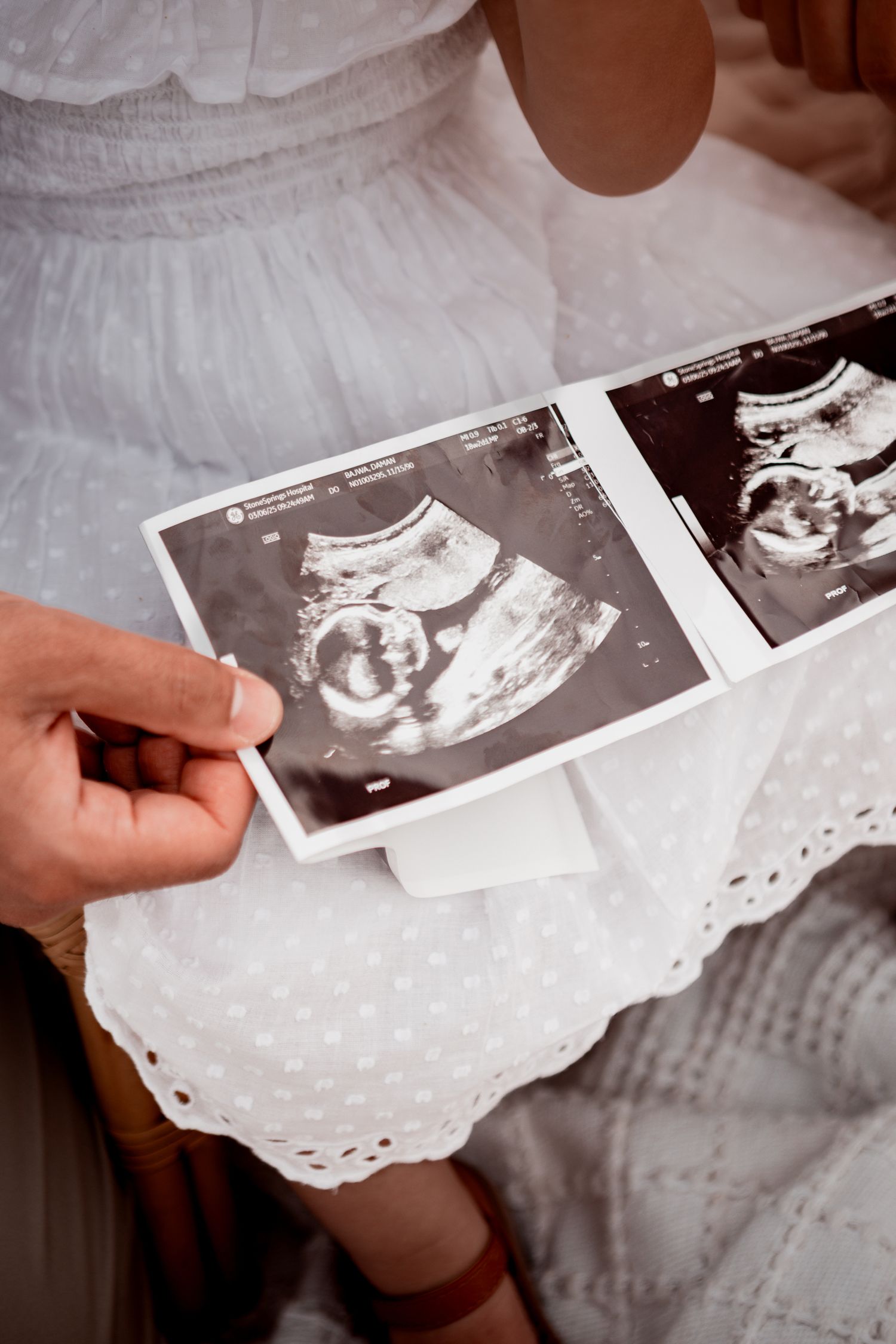 Hand holding ultrasound scan images showing fetal development on white lace fabric background.