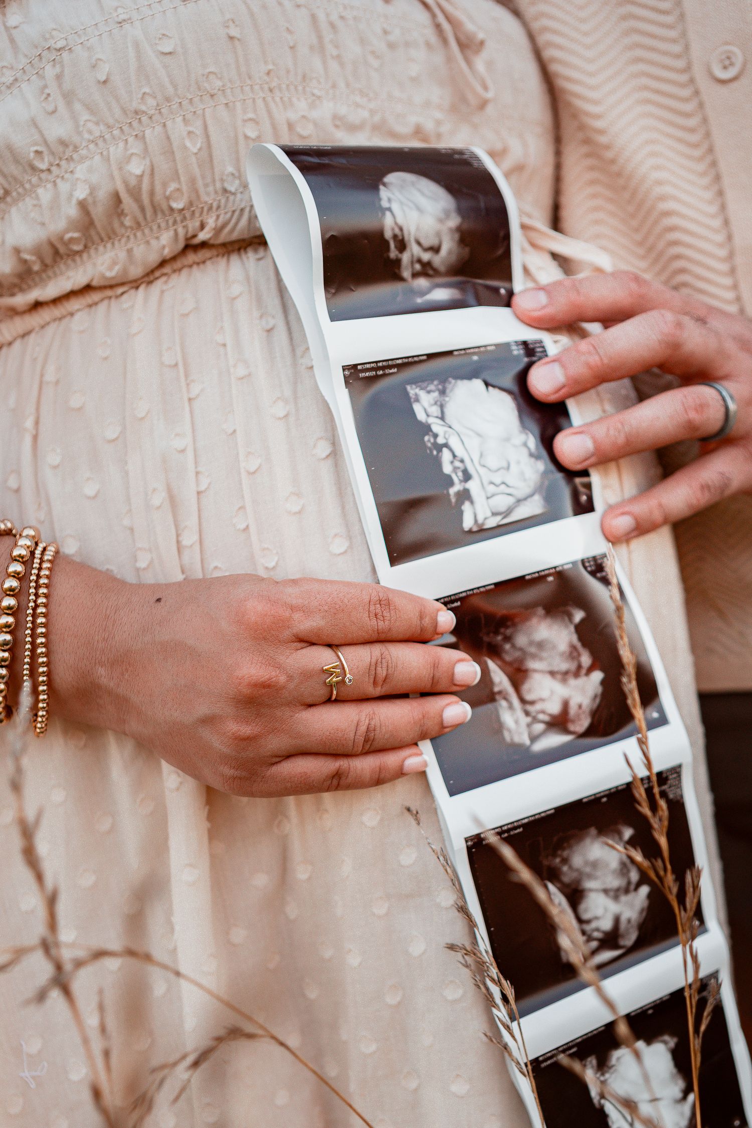 Hands holding ultrasound photos showing progression of pregnancy stages.
