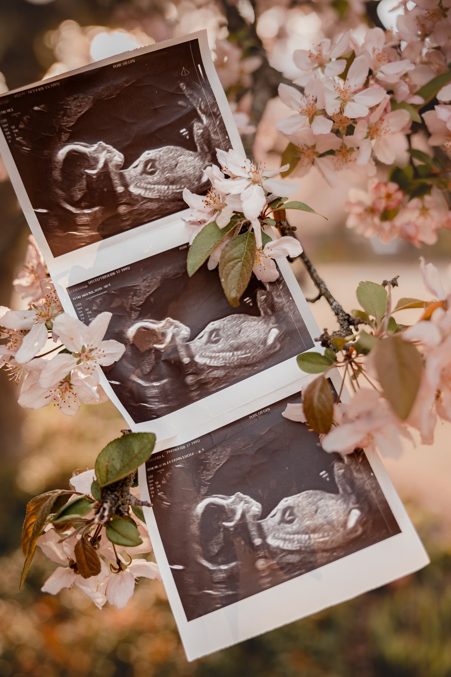 Three ultrasound photos displayed among blooming cherry blossom branches in soft pink spring light.