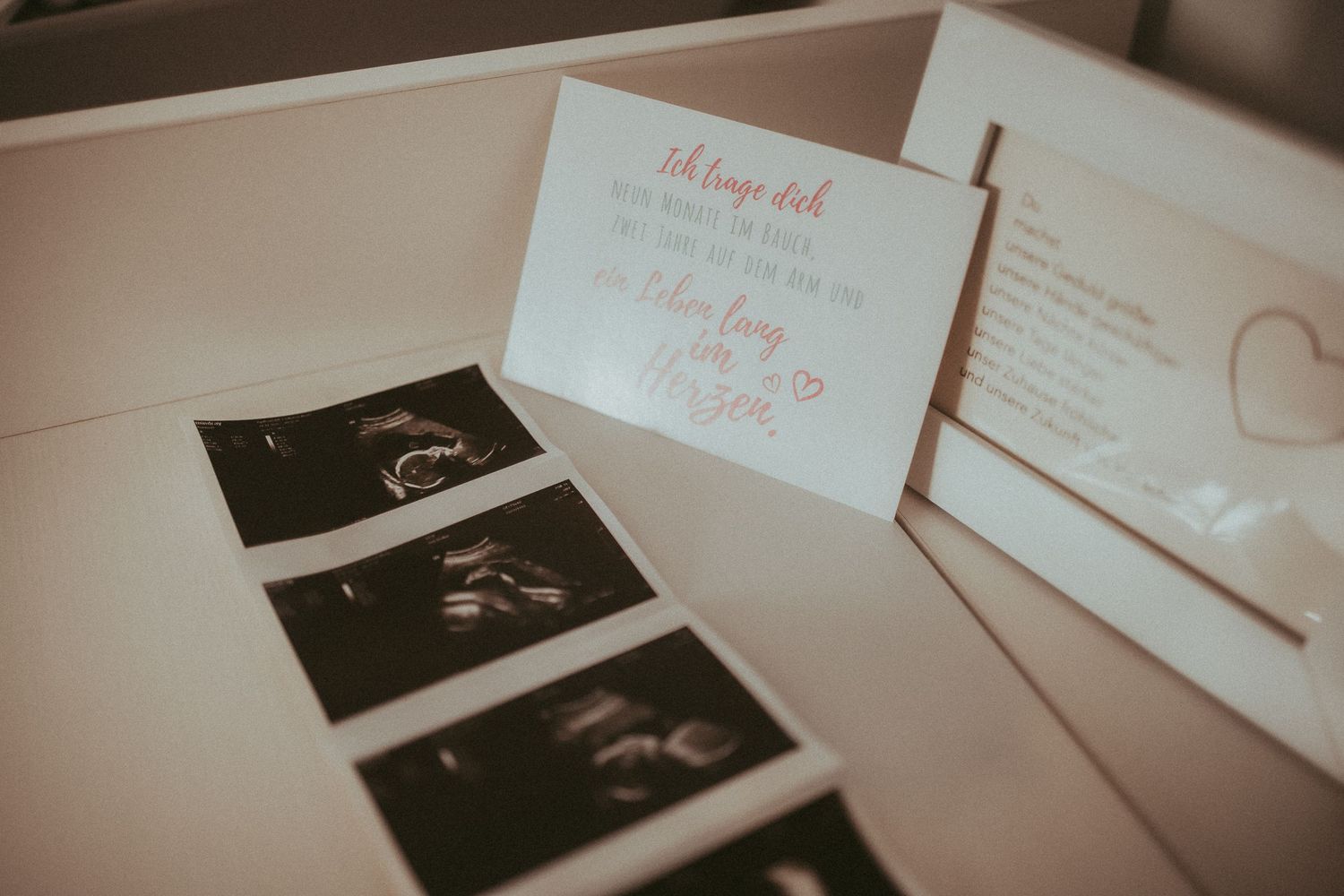 A series of ultrasound photos and pregnancy-related documents arranged in a row on a white surface.