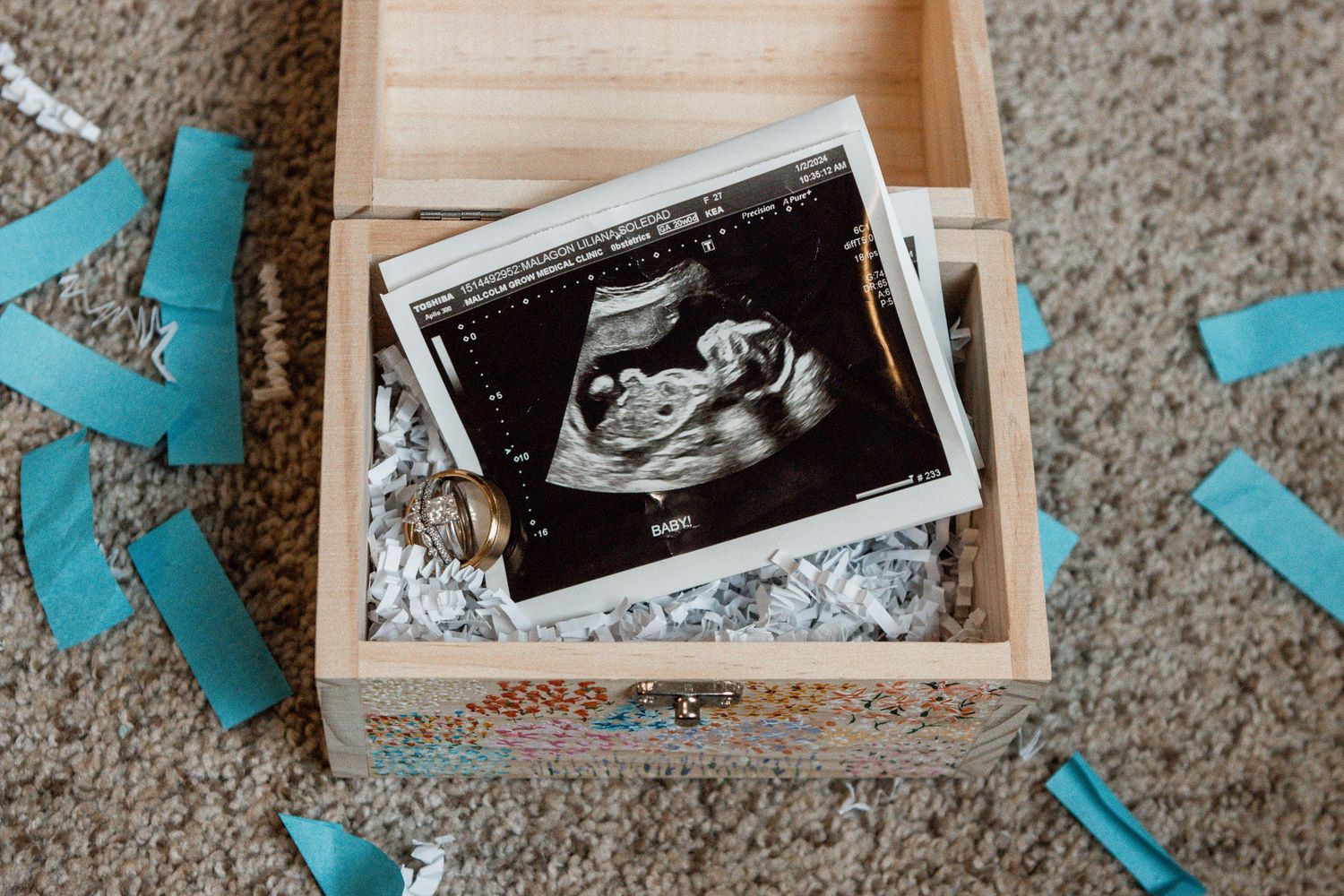 Black and white ultrasound images displayed with decorative teal paper butterflies on a gray carpet background.