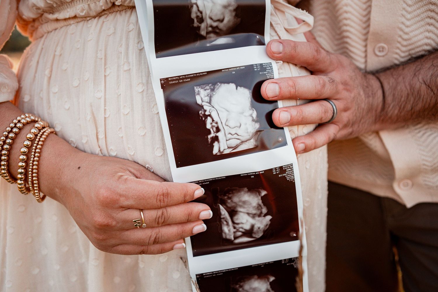 Close-up of hands holding ultrasound scan images while wearing a white dress and wooden bracelets.