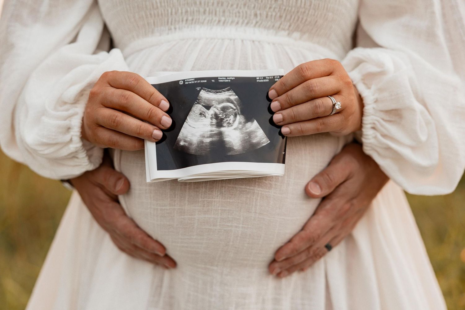 Pregnant woman in white dress holding ultrasound photo while partner embraces her baby bump outdoors.