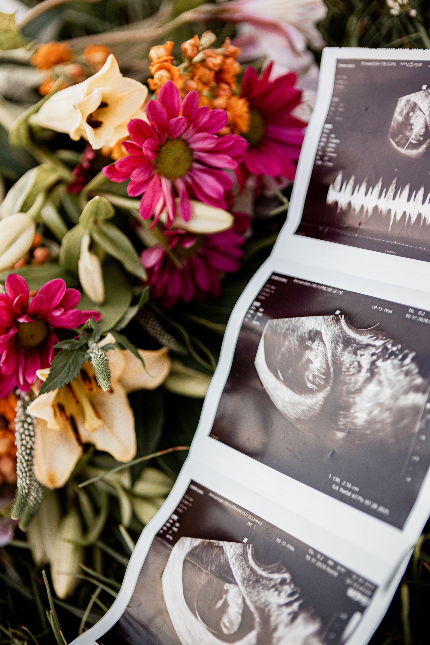 Ultrasound sonogram images placed beside vibrant pink daisies and orange flowers in a floral arrangement.
