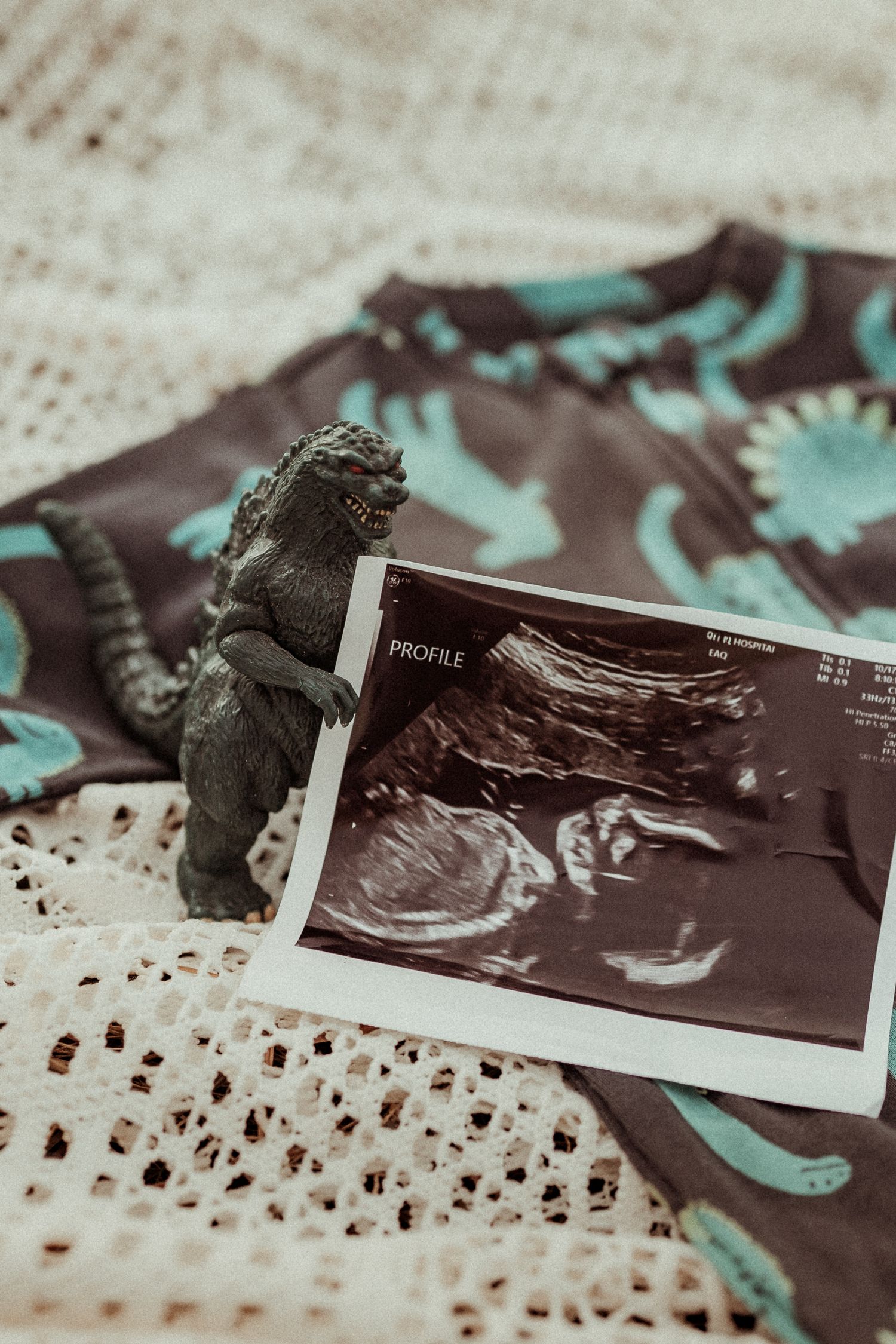 A collection of ultrasound sonogram photos arranged in a row on a textured surface with teal accents.