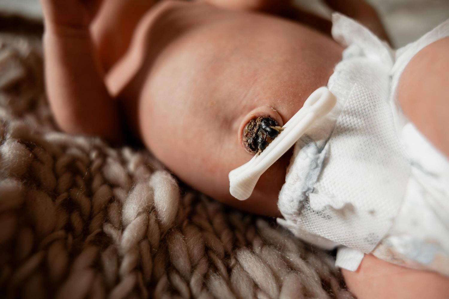 Newborn baby belly button with umbilical cord clamp drying naturally, close-up photo of infant navel care.