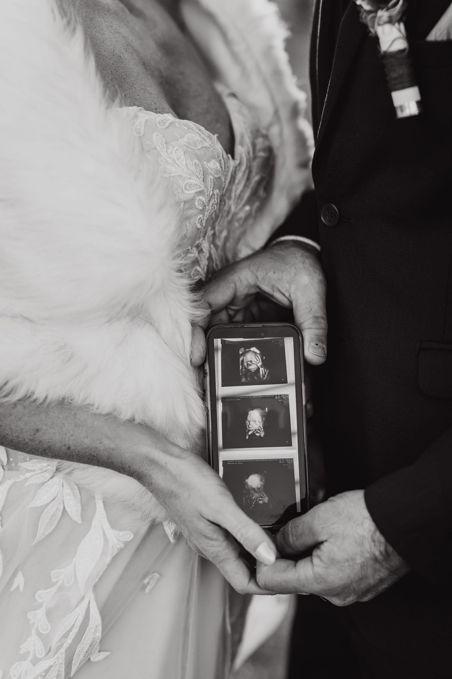 Black and white sequence showing hands holding a small photograph against a white dress fabric background.