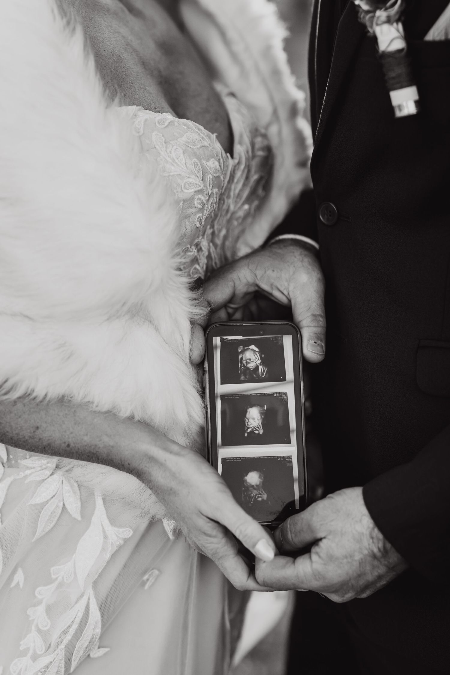 Black and white photo of wedding couple holding ultrasound photos together in intimate moment.