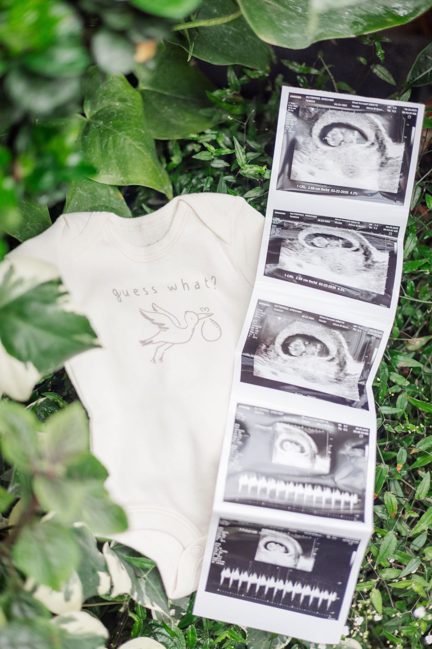 Ultrasound photos and a white garment laid out on green foliage background.
