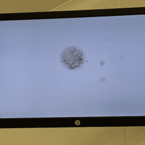 An image of an embryo ready for an embryo transfer during the ivf process