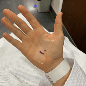 An image of a hand and the number of eggs collected after an egg retrieval