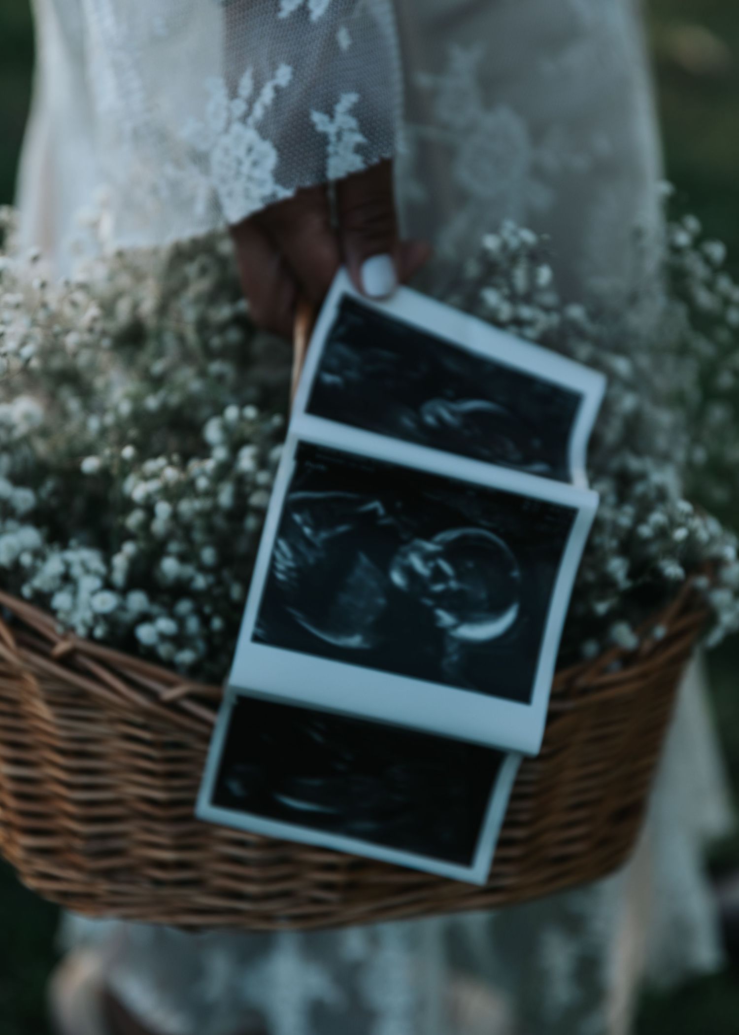 Ultrasound photos displayed in a basket with delicate baby's breath flowers.