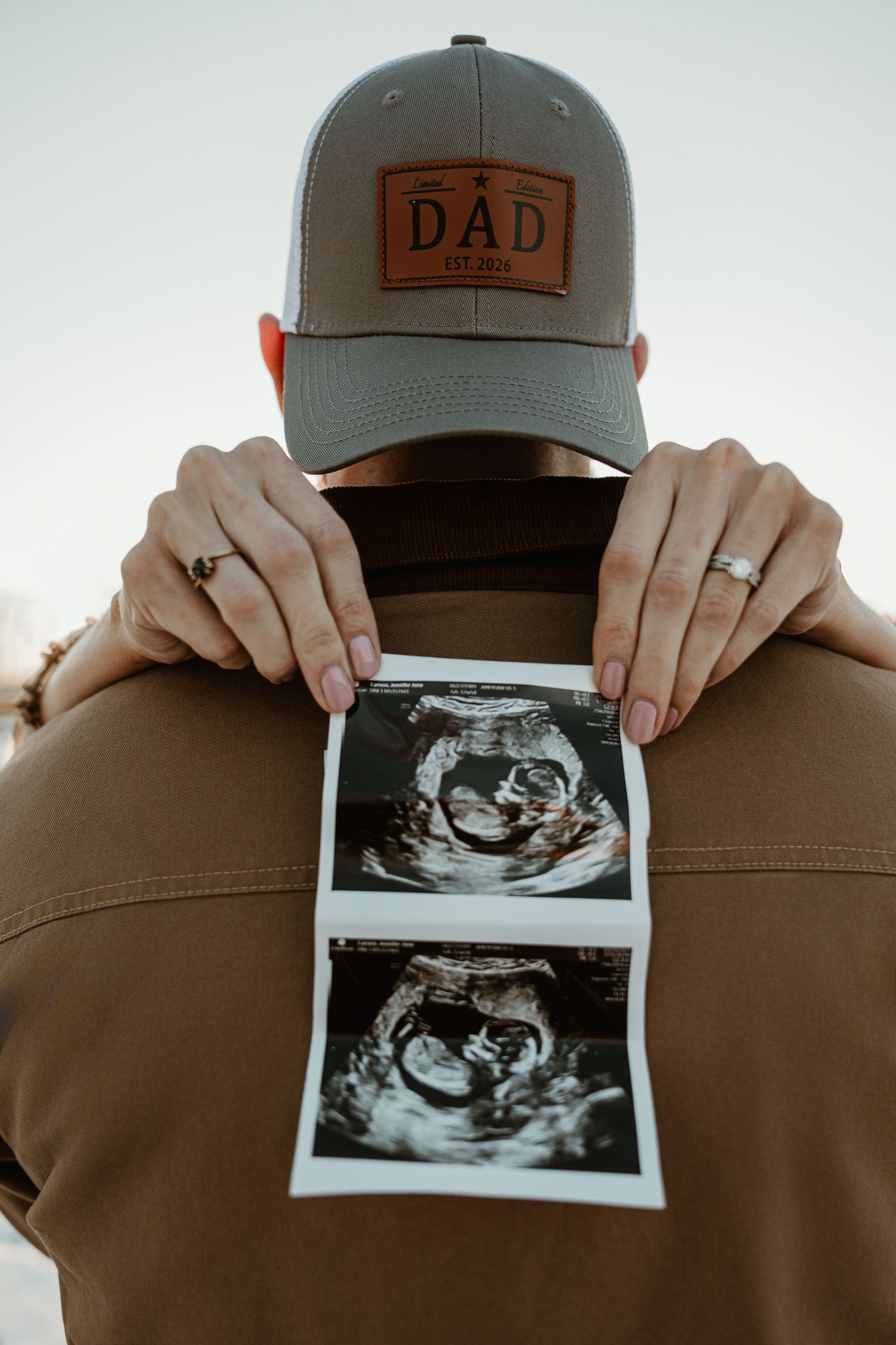 Person wearing a brown dad hat holds up a black and white ultrasound photo showing a developing baby.