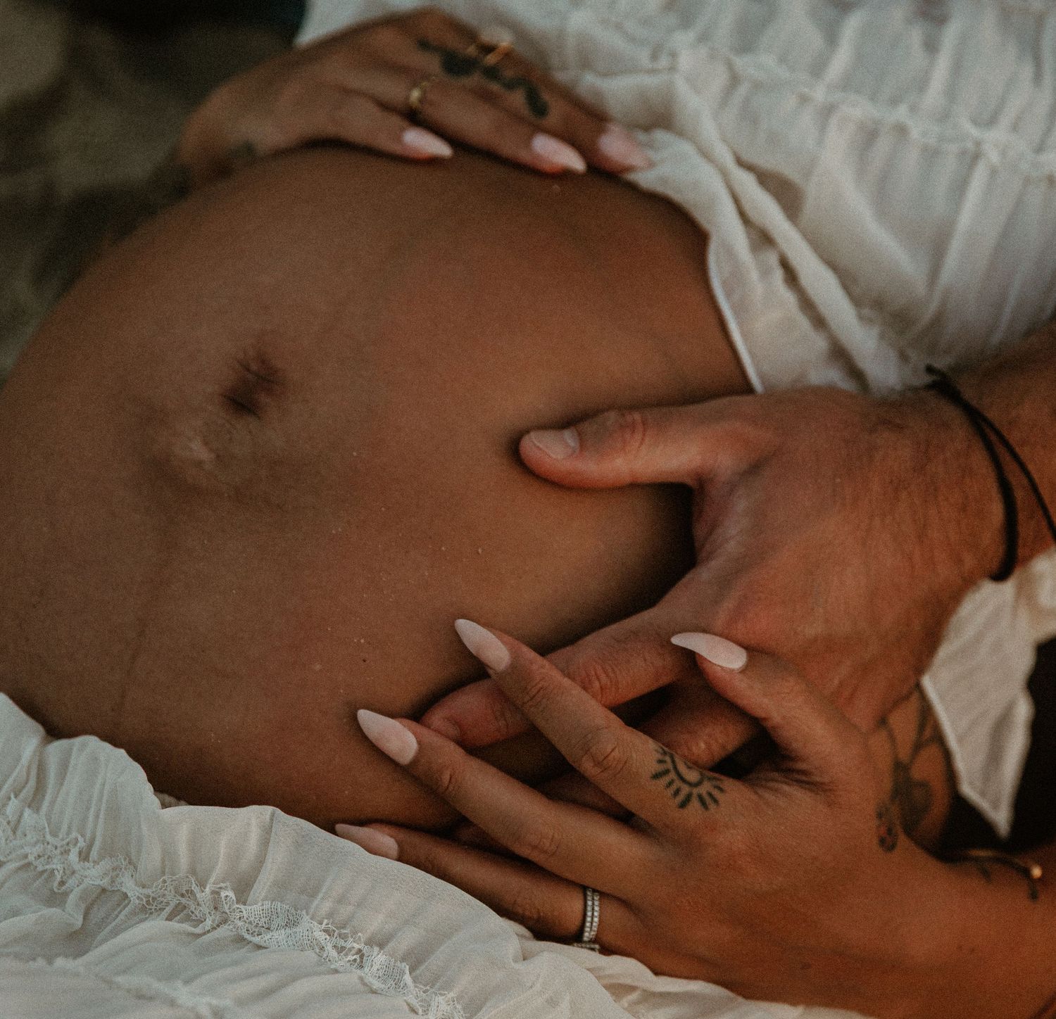 Close up of hands with wedding rings resting on skin.
