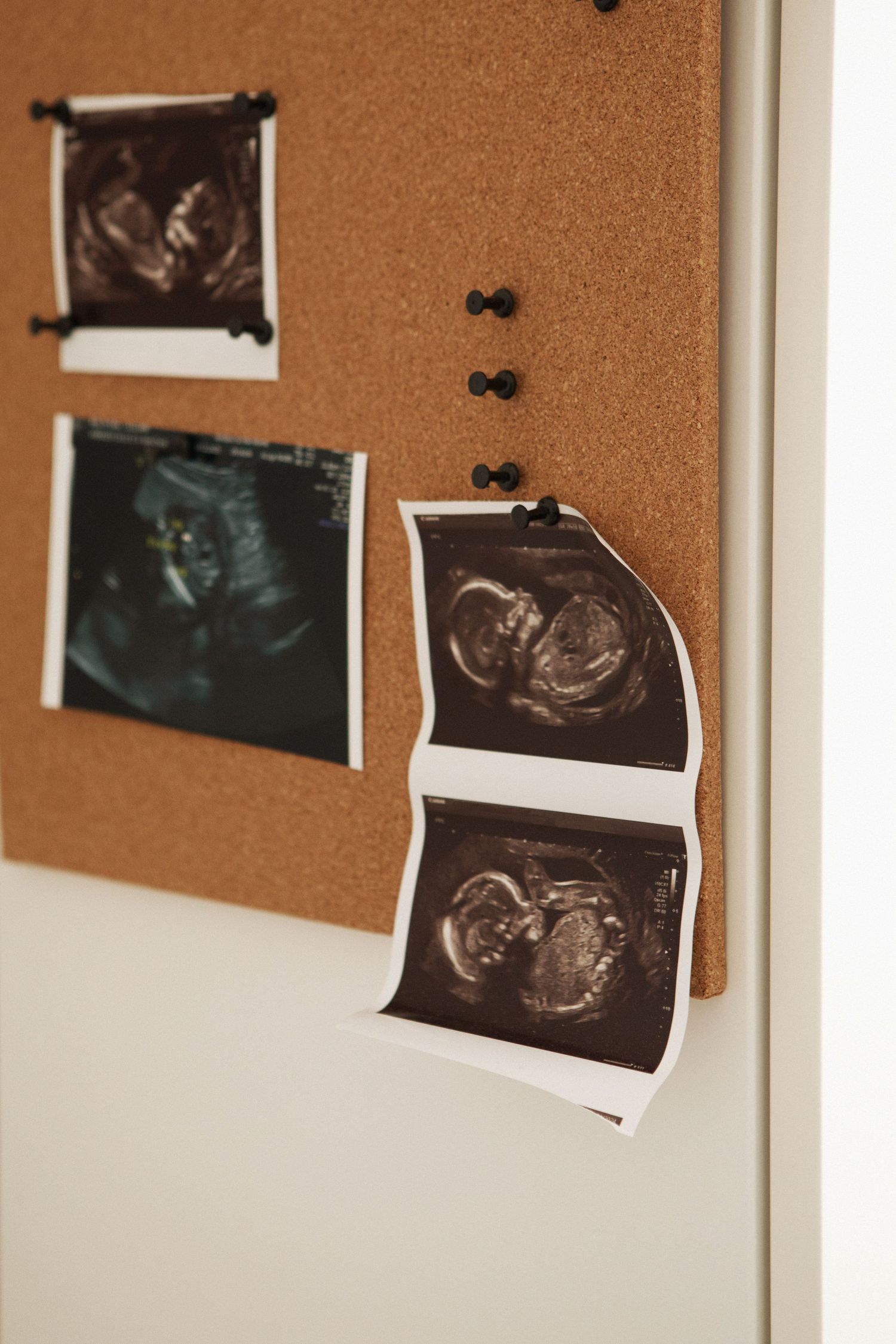 Multiple baby ultrasound scan photos pinned to a cork notice board mounted on a white wall.