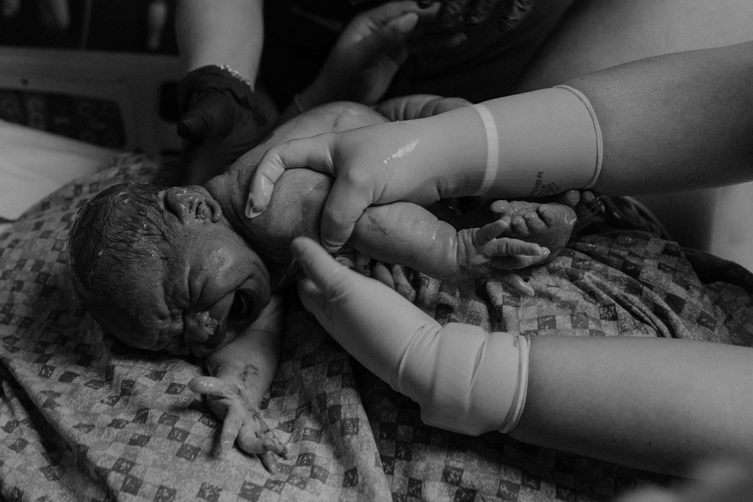 Black and white photo of medical team's hands supporting a newborn baby moments after birth. top rated RI birth photographer