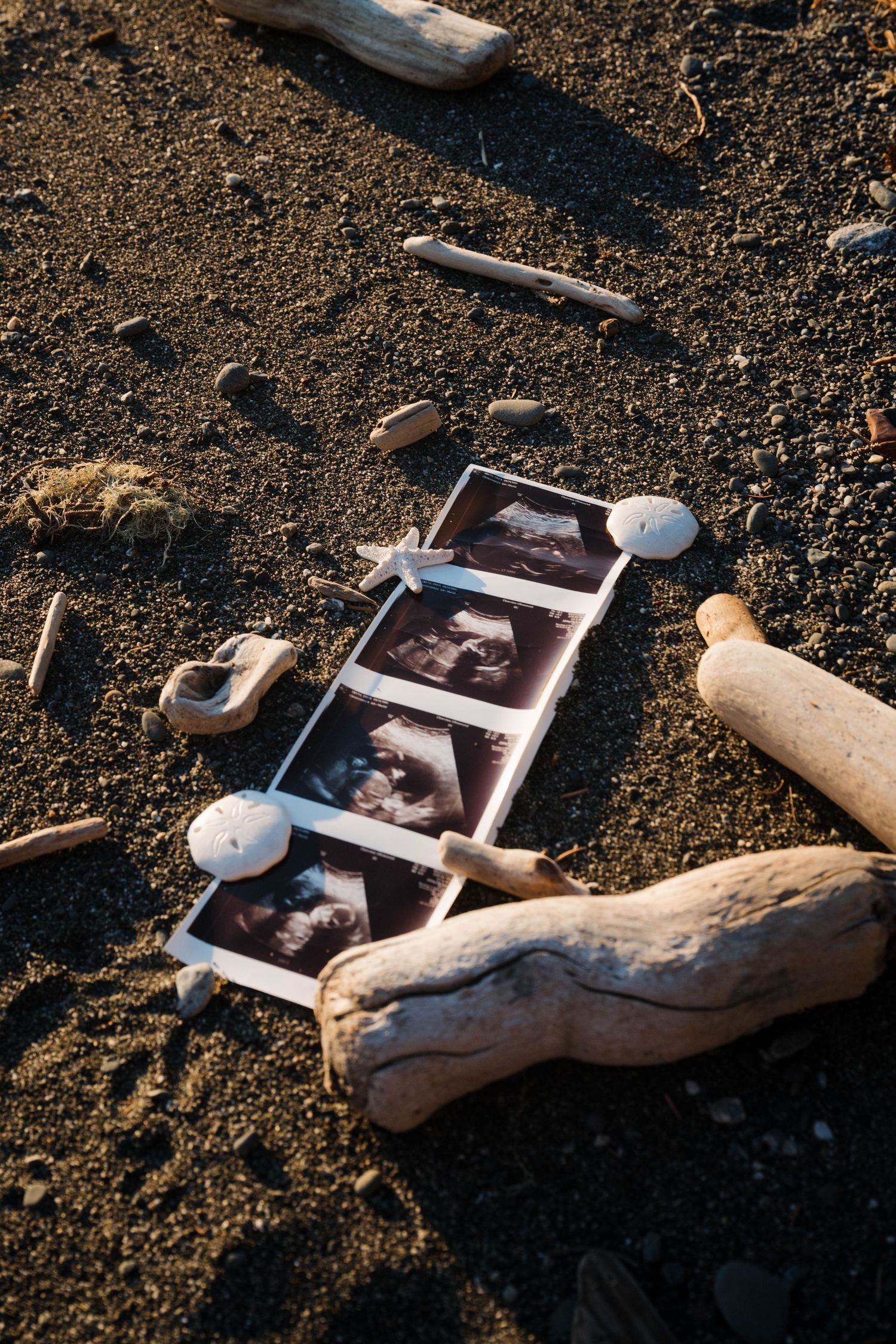 Ultrasound photos arranged on sandy beach with driftwood and seashells in warm sunlight.