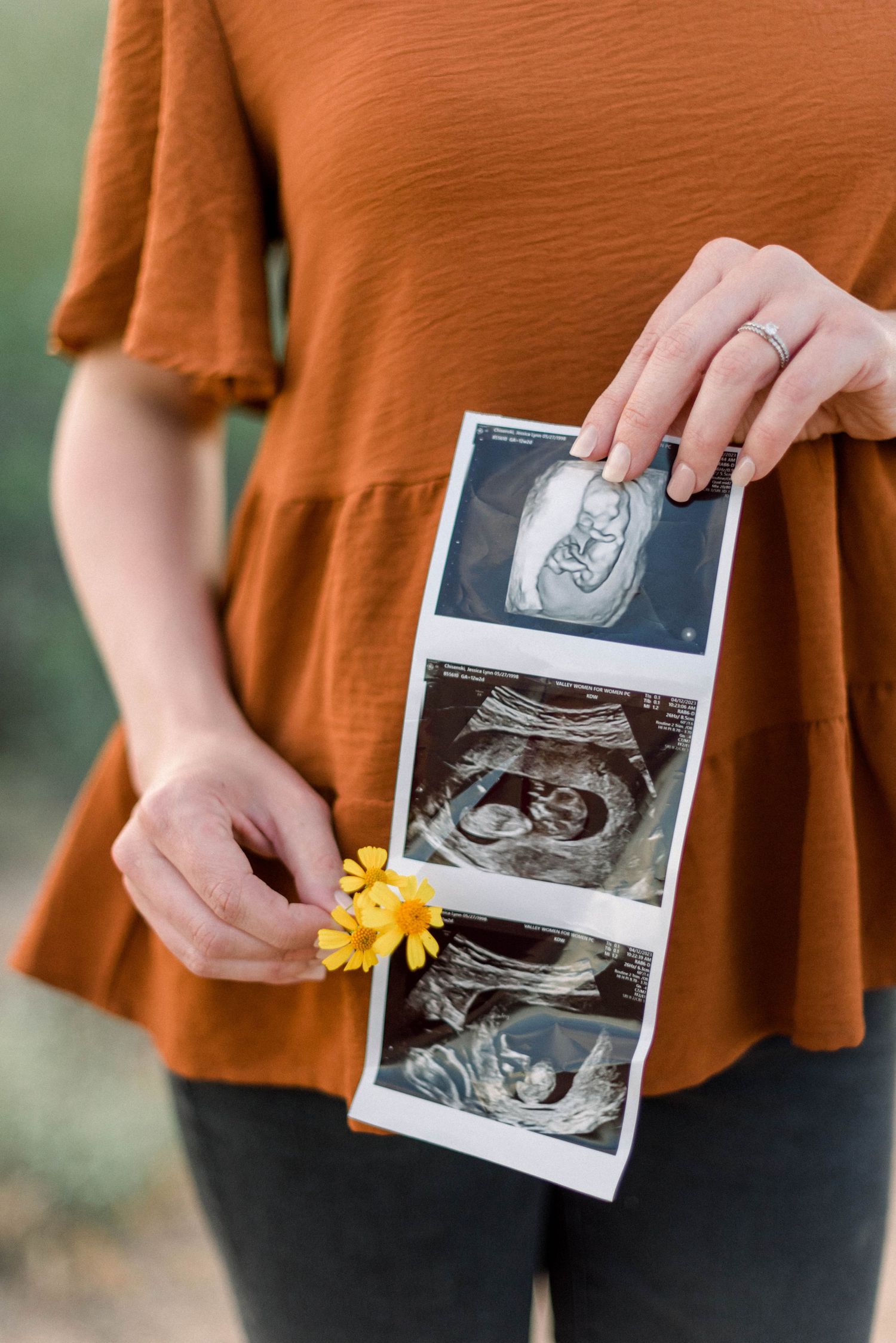 Hands holding ultrasound photos with yellow wildflower against rust-colored clothing.