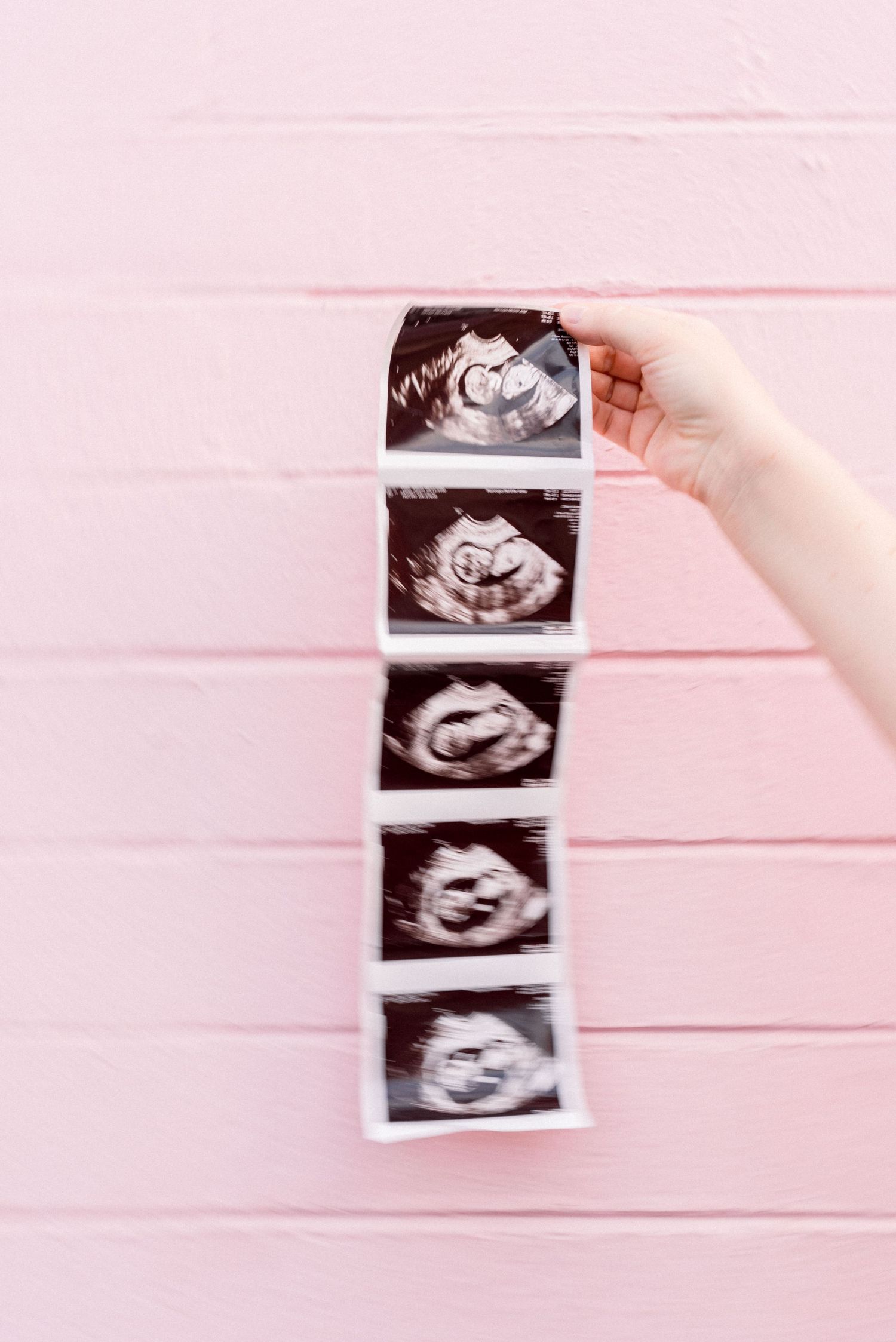 Black and white ultrasound photos displayed on a pink wooden background.