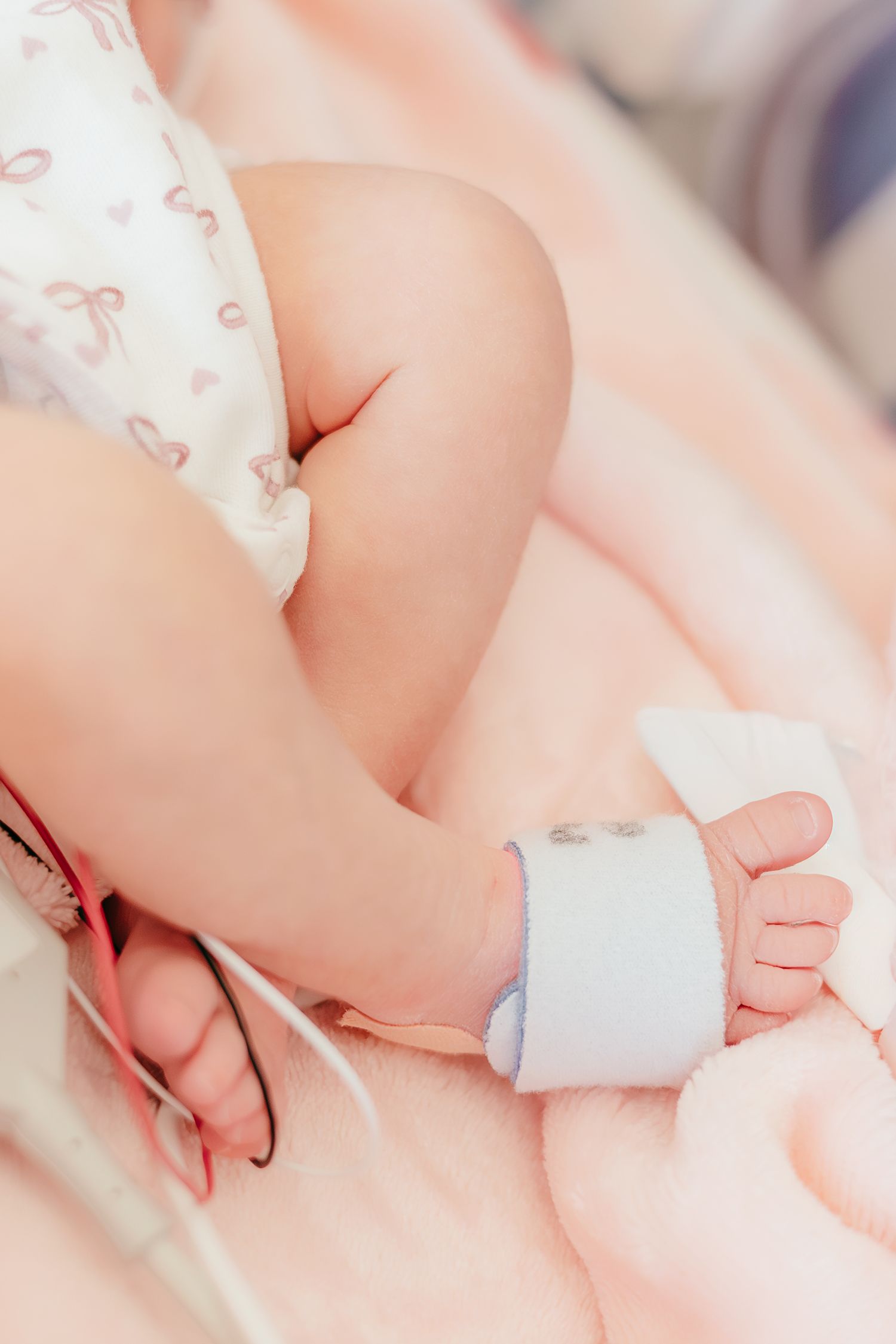 Close-up of newborn baby feet with a hospital monitoring sensor attached in a medical facility.