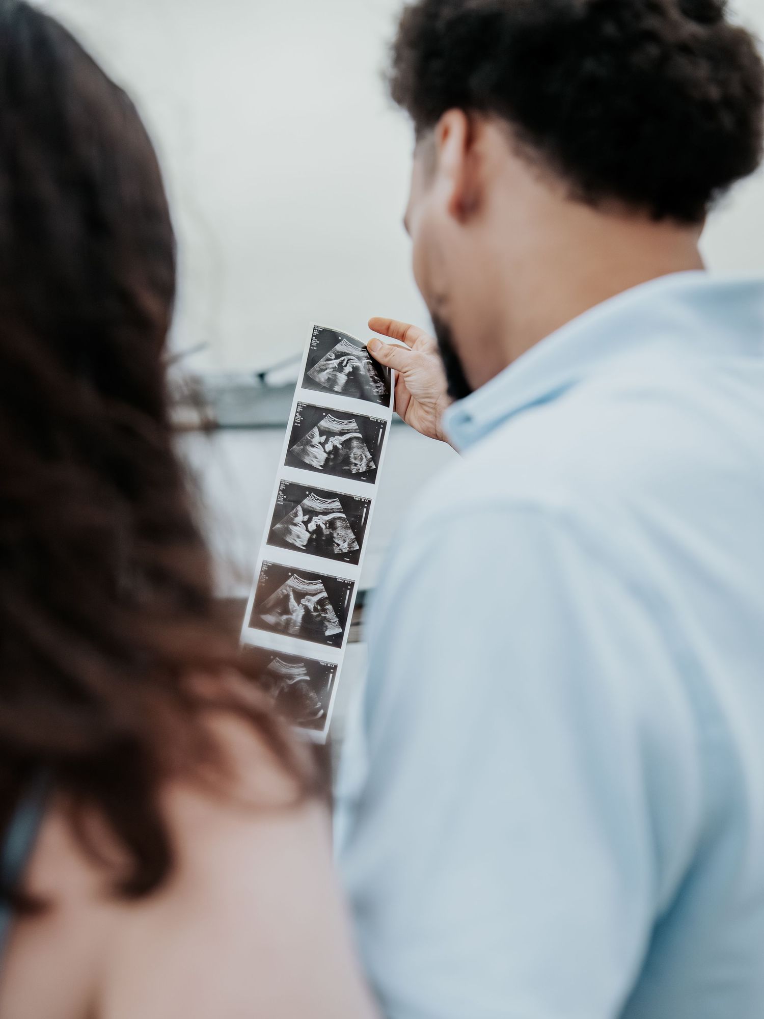 Couple kissing while holding ultrasound sonogram strip photos, pregnancy announcement moment captured outdoors.