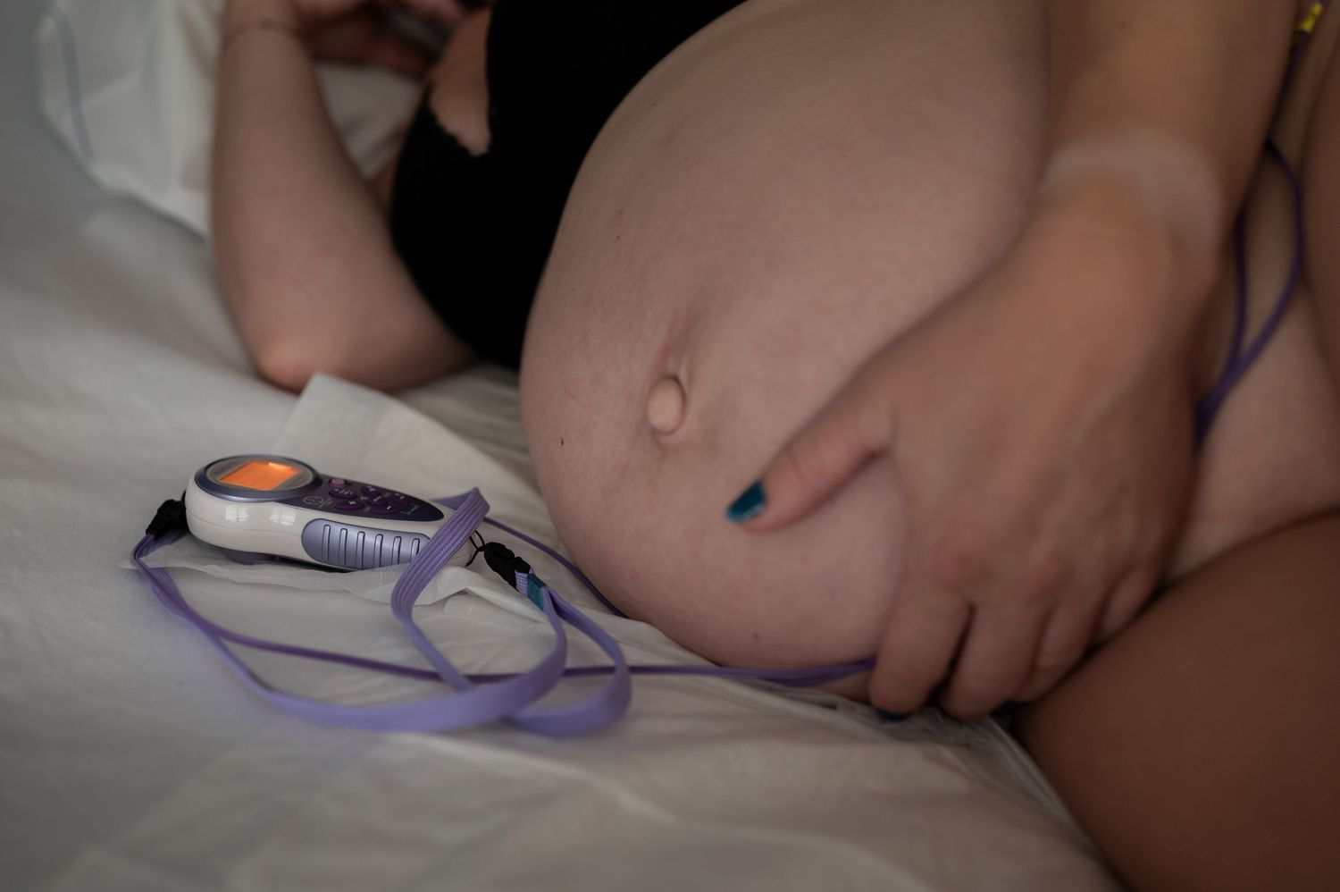Close-up of a pregnant woman's bare belly with a fetal heart rate monitor on a bed.