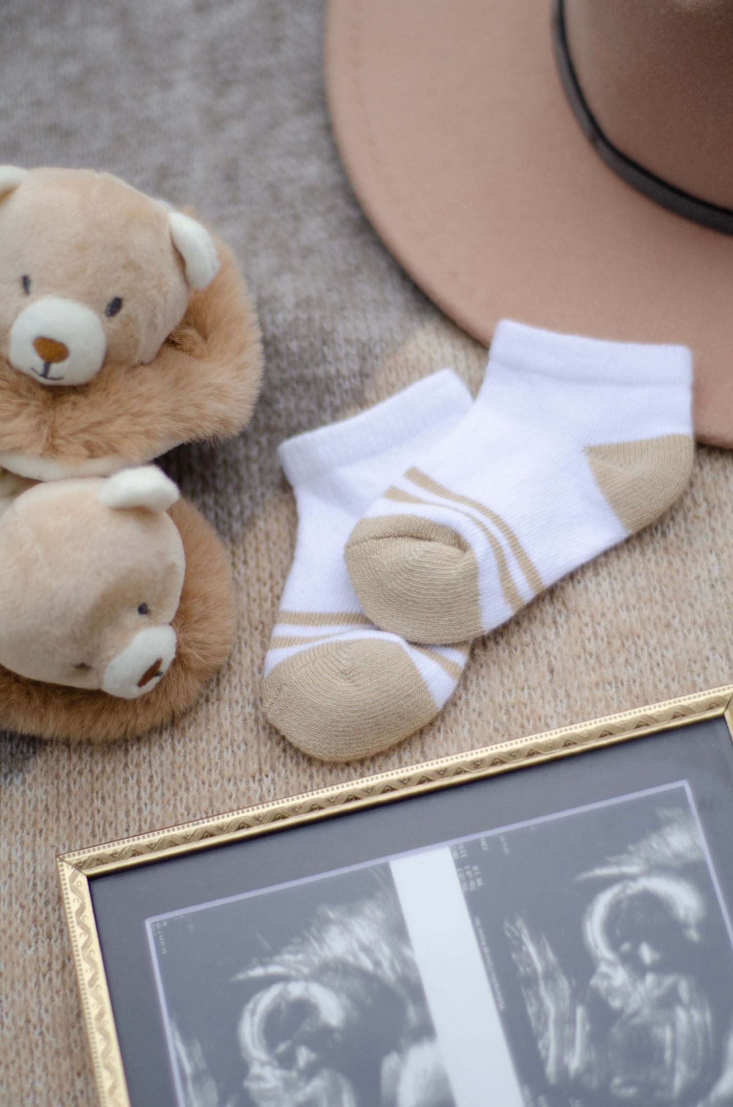 Sonogram images displayed with white socks and plush toys on textured fabric.