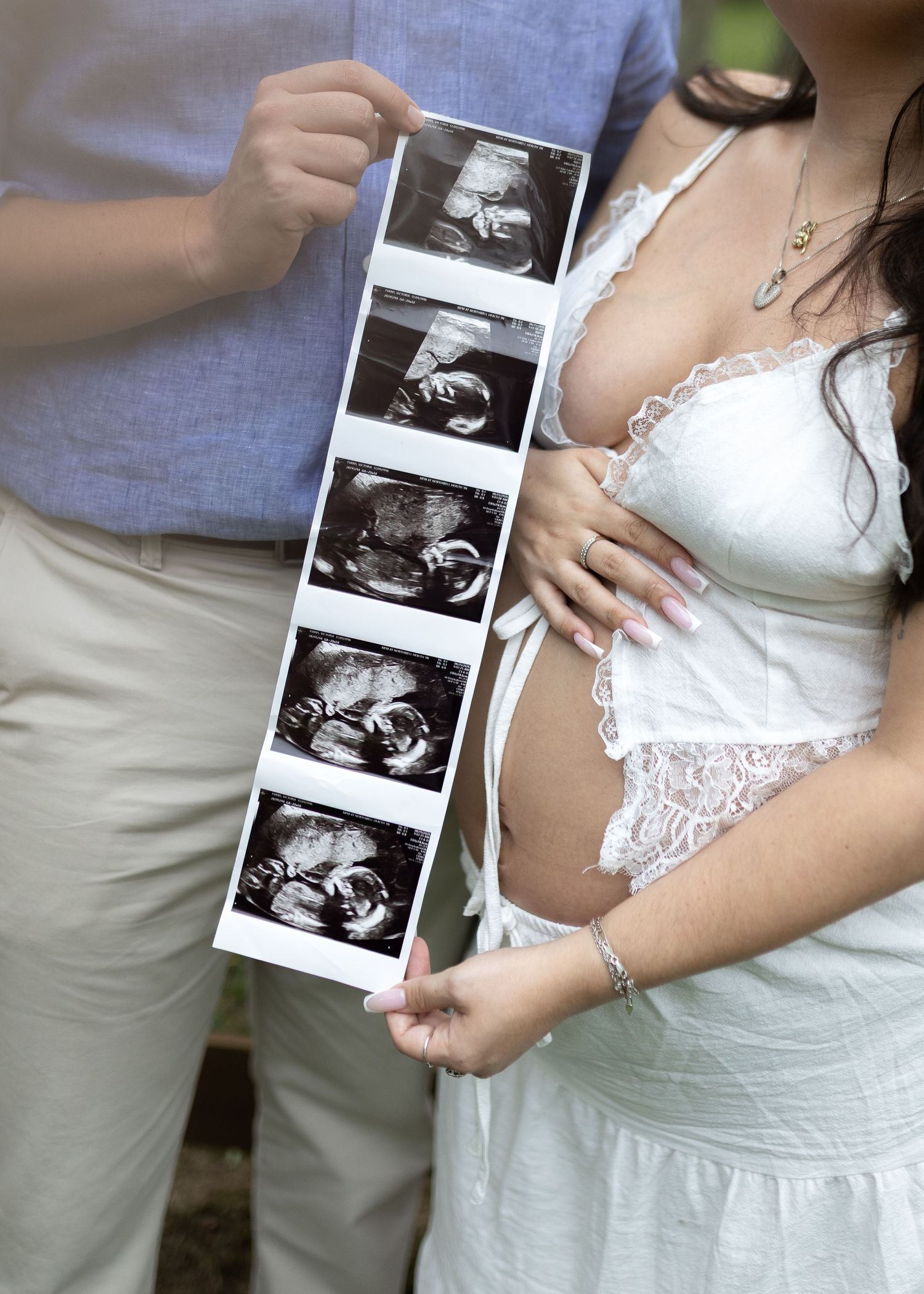 Pregnant couple holding ultrasound sonogram strip photos showing baby development during maternity photo shoot outdoors.