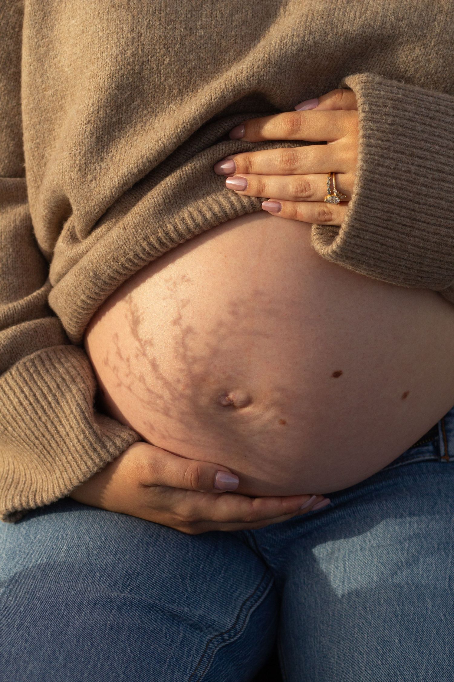 Close-up of pregnant belly with stretch marks, cradled by hands with pink nails and rings.