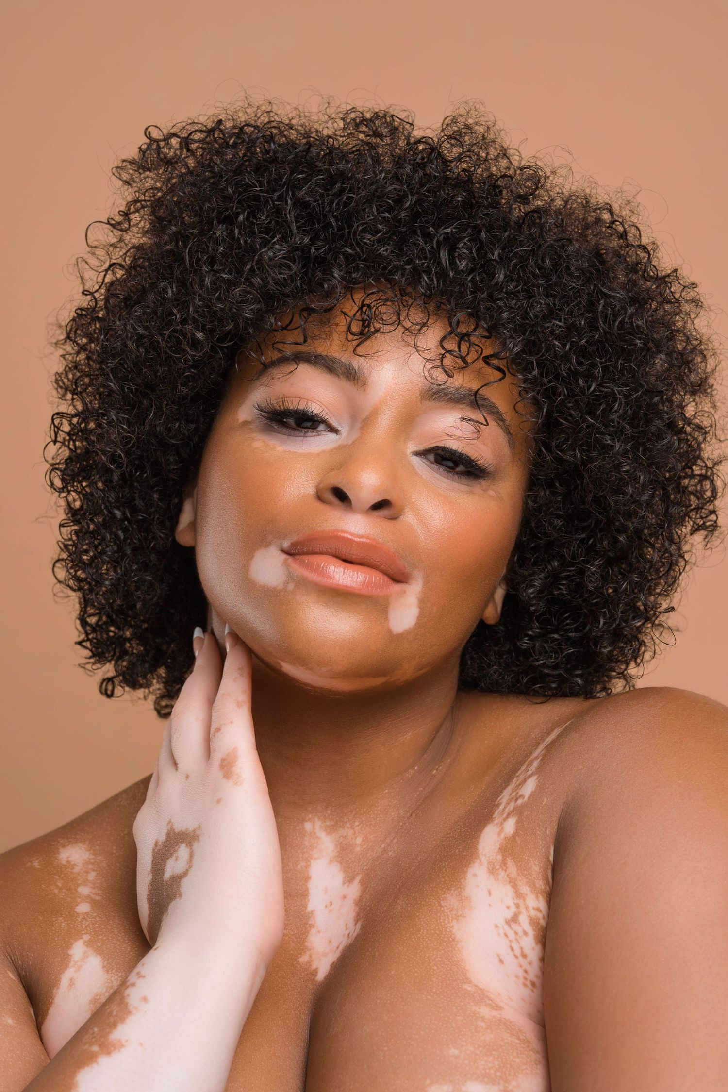 Beauty portraits showing vitiligo skin patterns with natural curly hair and glowing makeup.