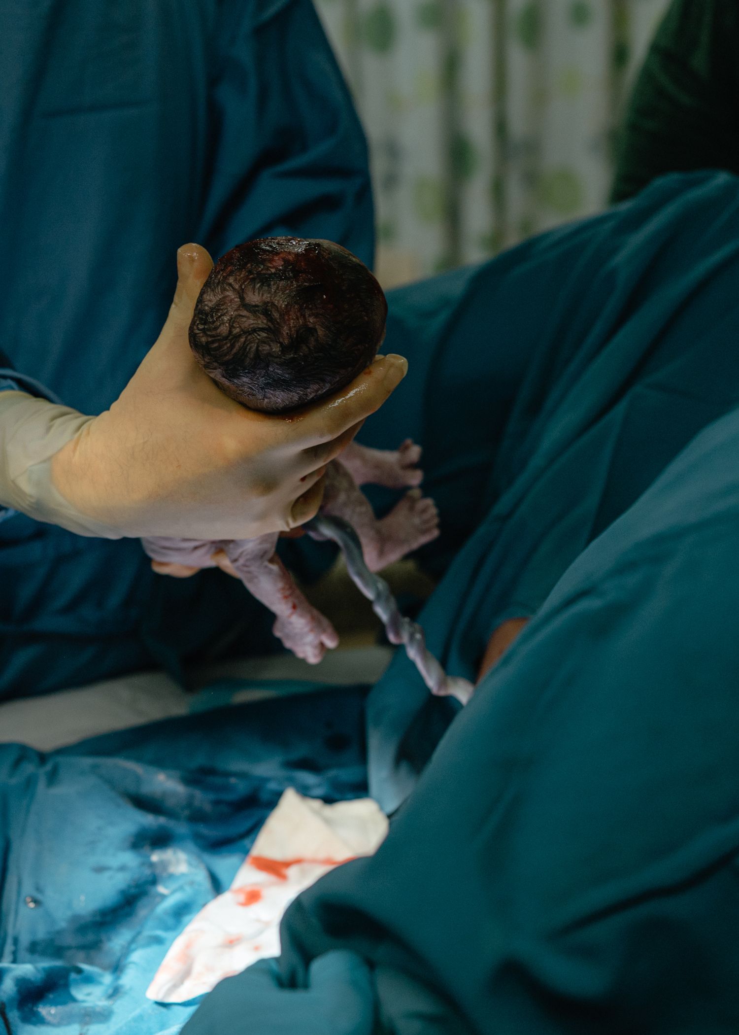 Gloved hand holds a newborn baby with dark hair just delivered during a cesarean section as surgeons in teal gowns look on.