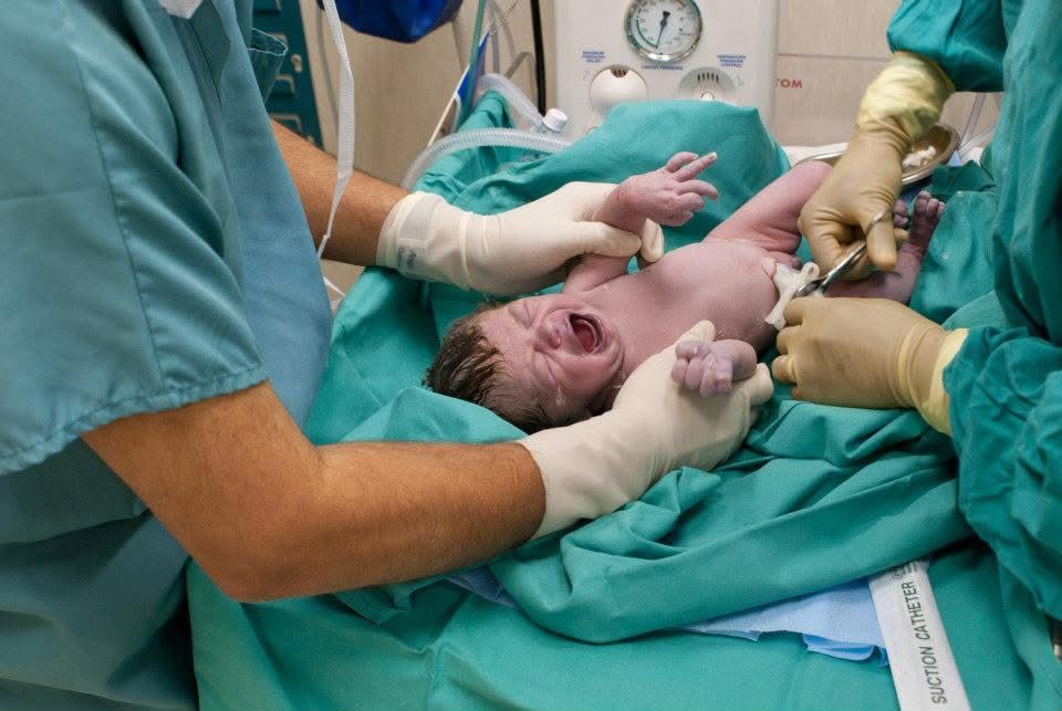 Medical staff in green scrubs and gloves handle a crying newborn baby on a surgical drape right after birth.