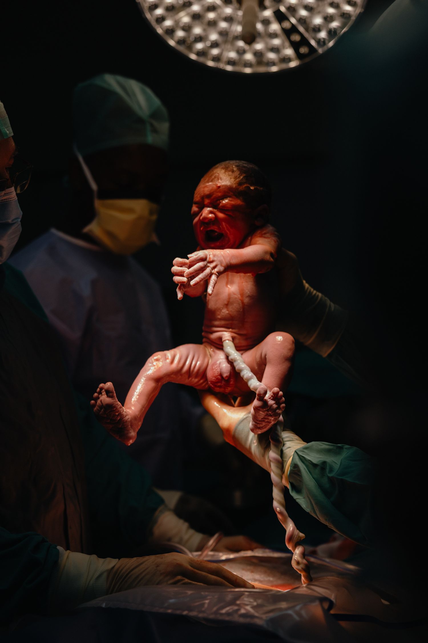 Surgeons in masks and scrubs lift a newborn baby with the umbilical cord still attached under bright operating room lights.