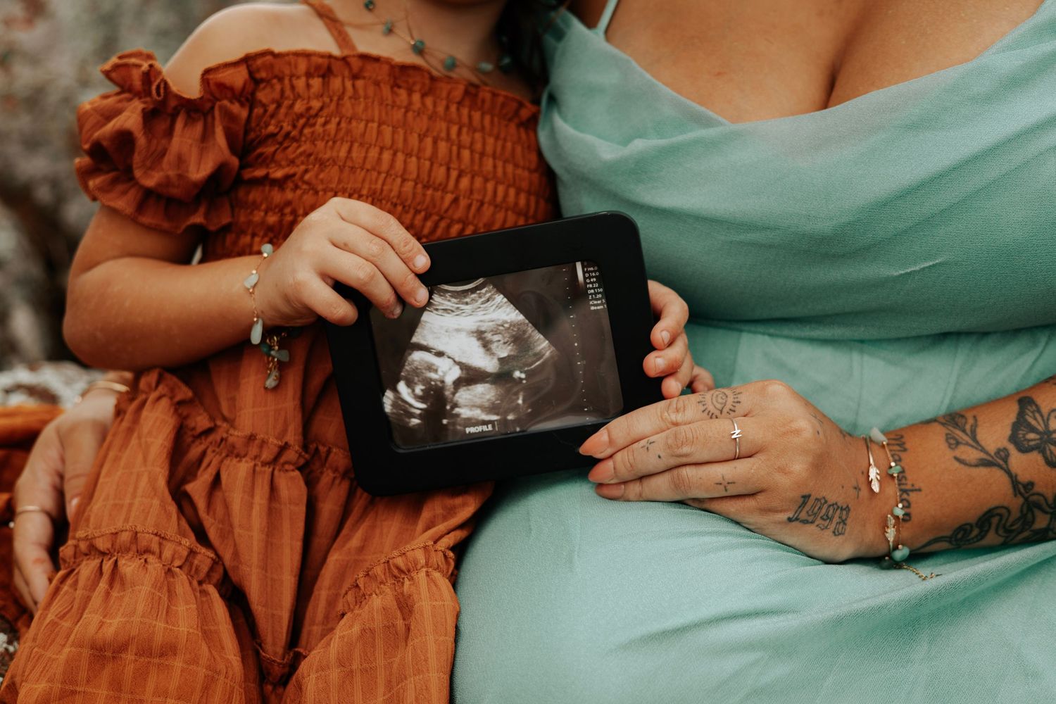 Close-up of hands holding ultrasound photo while wearing mint and rust-colored dresses.
