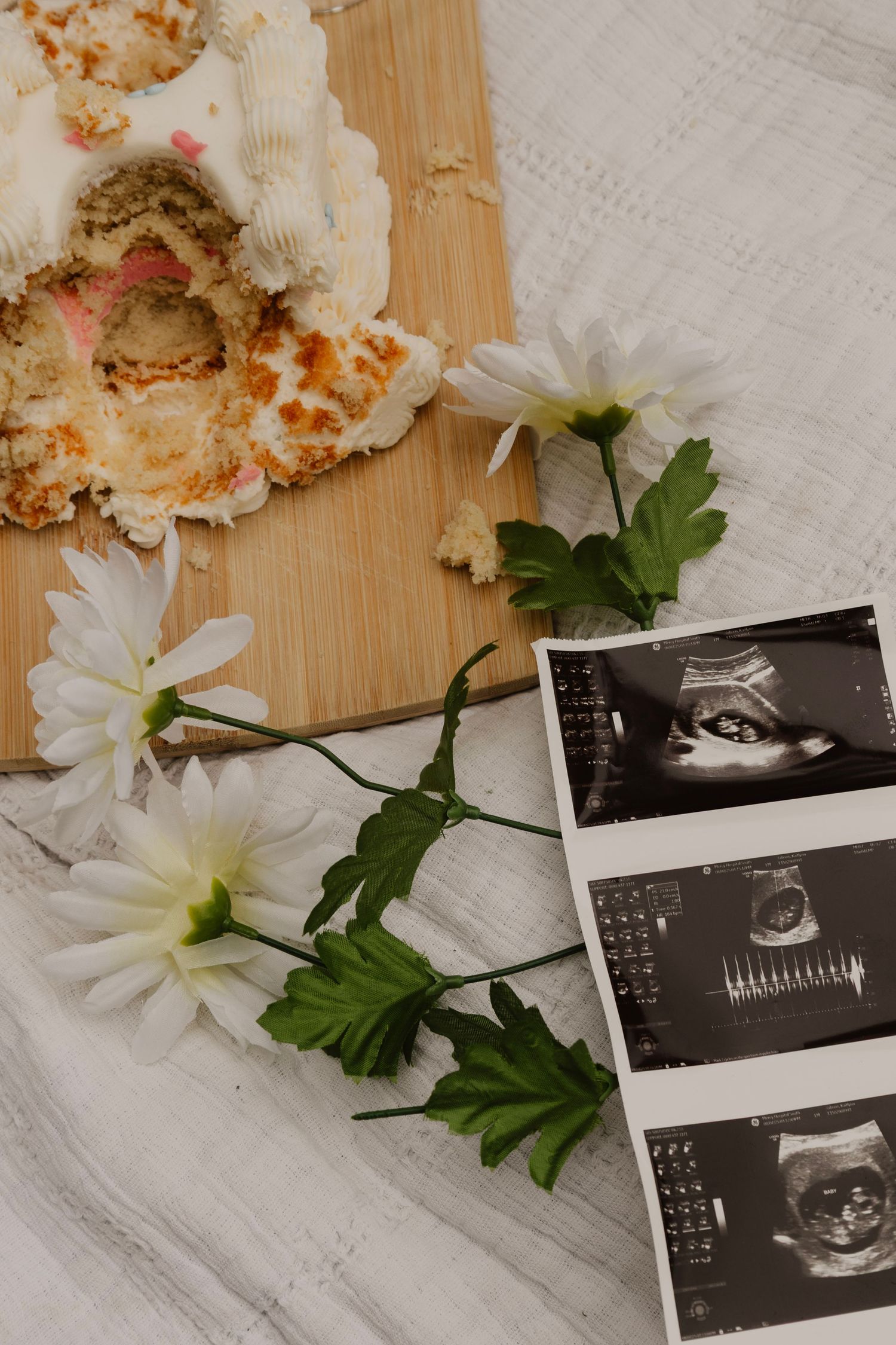 Ultrasound photos arranged with white daisies and parsley on a wooden surface.