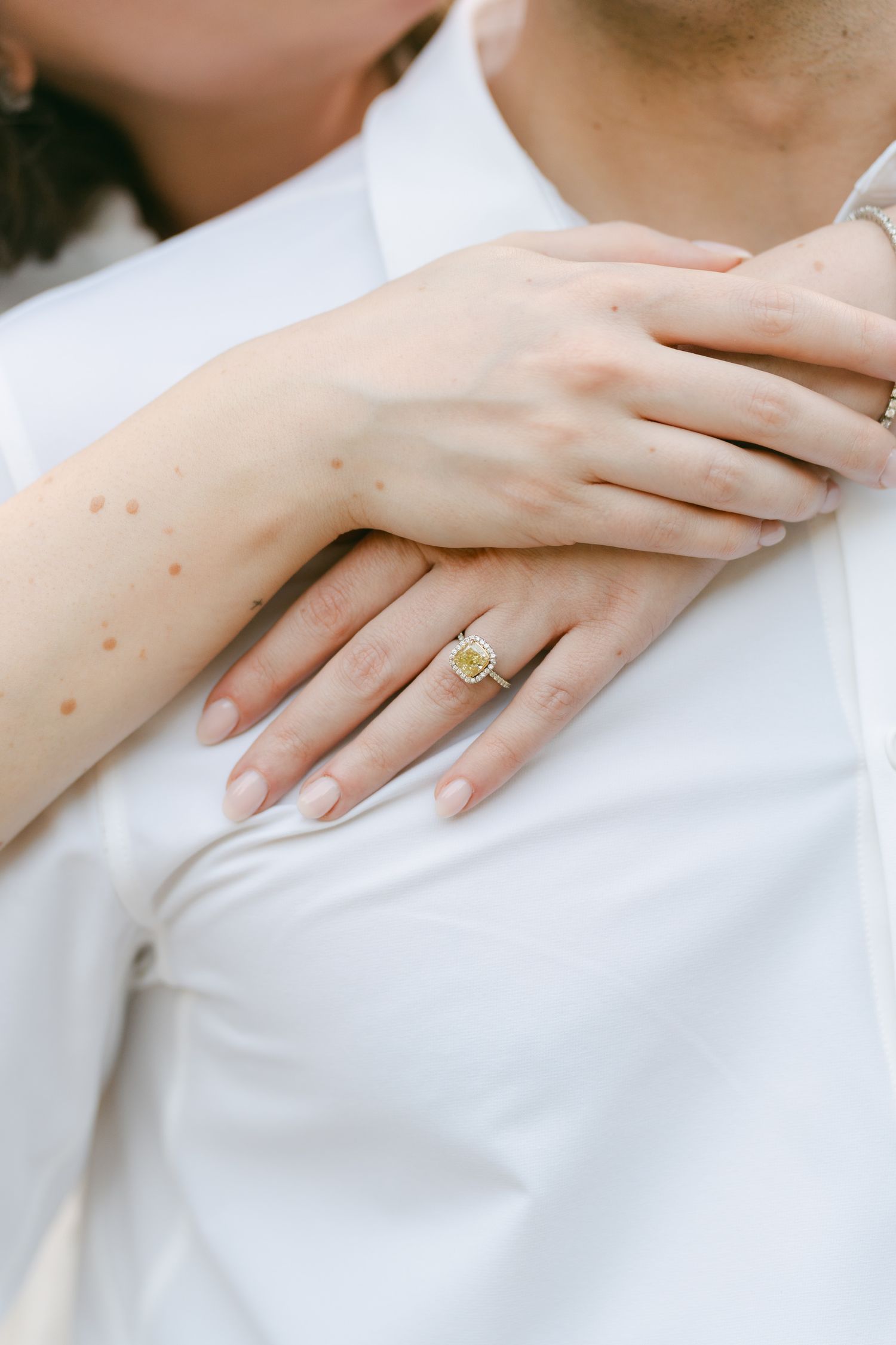Close-up of hands showing off an engagement ring against a white shirt background.
