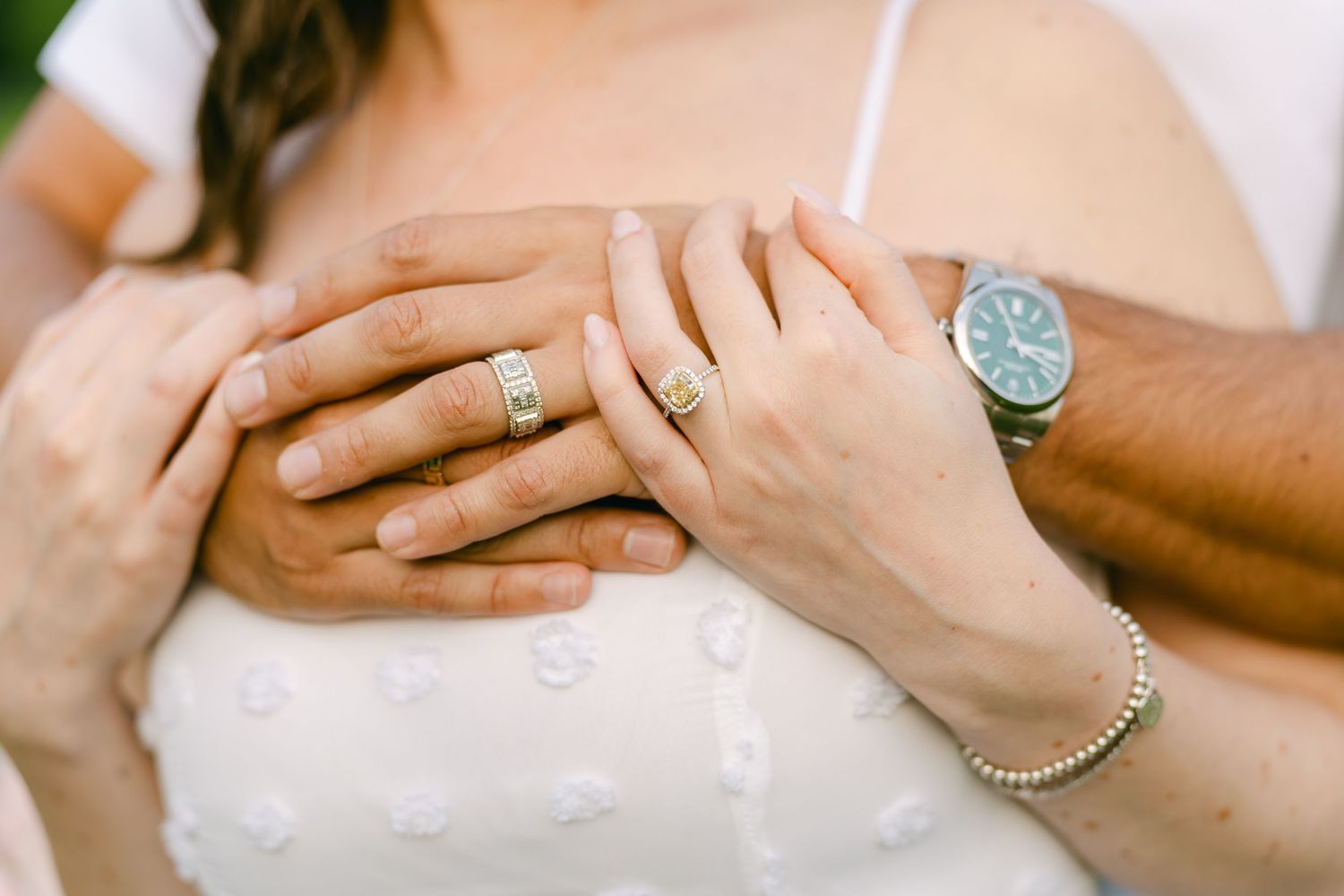 Close-up of hands showing engagement ring and watch details against white fabric.