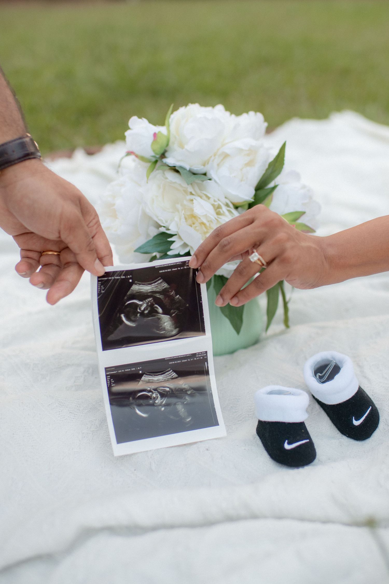 Ultrasound photos and baby shoes arranged on a white blanket with floral decorations.