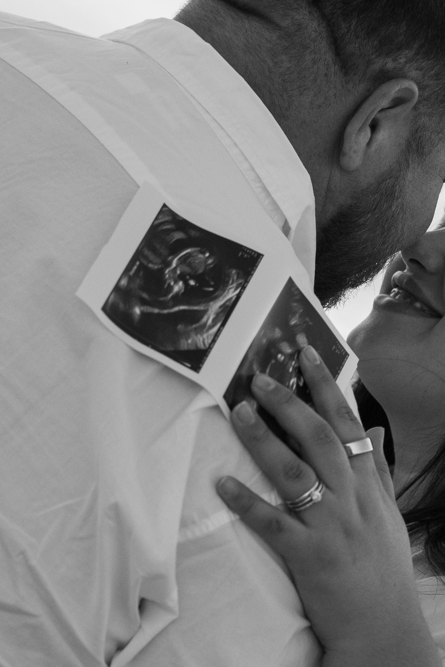 Black and white photo of a couple kissing while holding ultrasound scans, announcing their pregnancy.