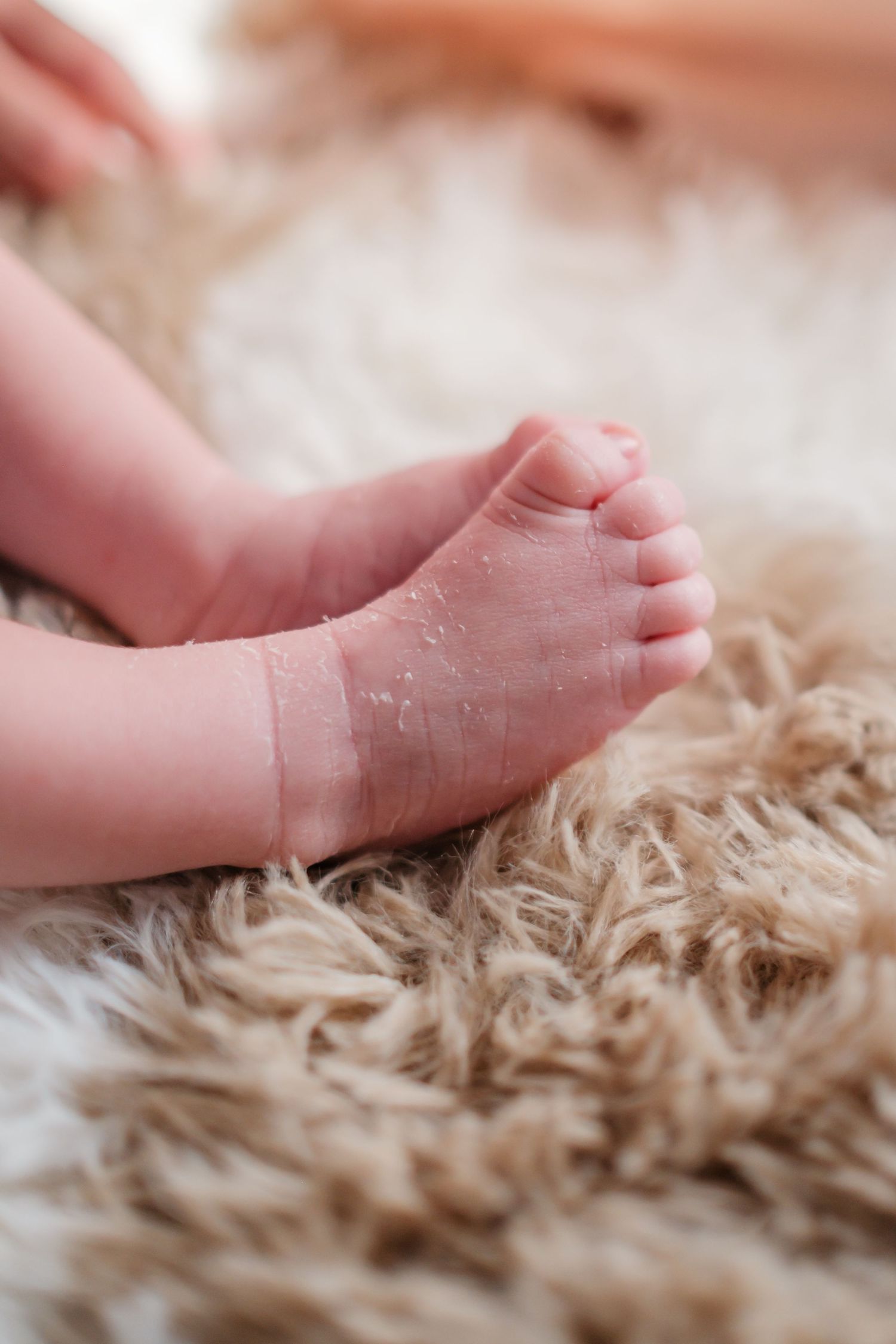 Close-up of newborn baby feet with peeling skin resting on a soft fluffy beige rug.
