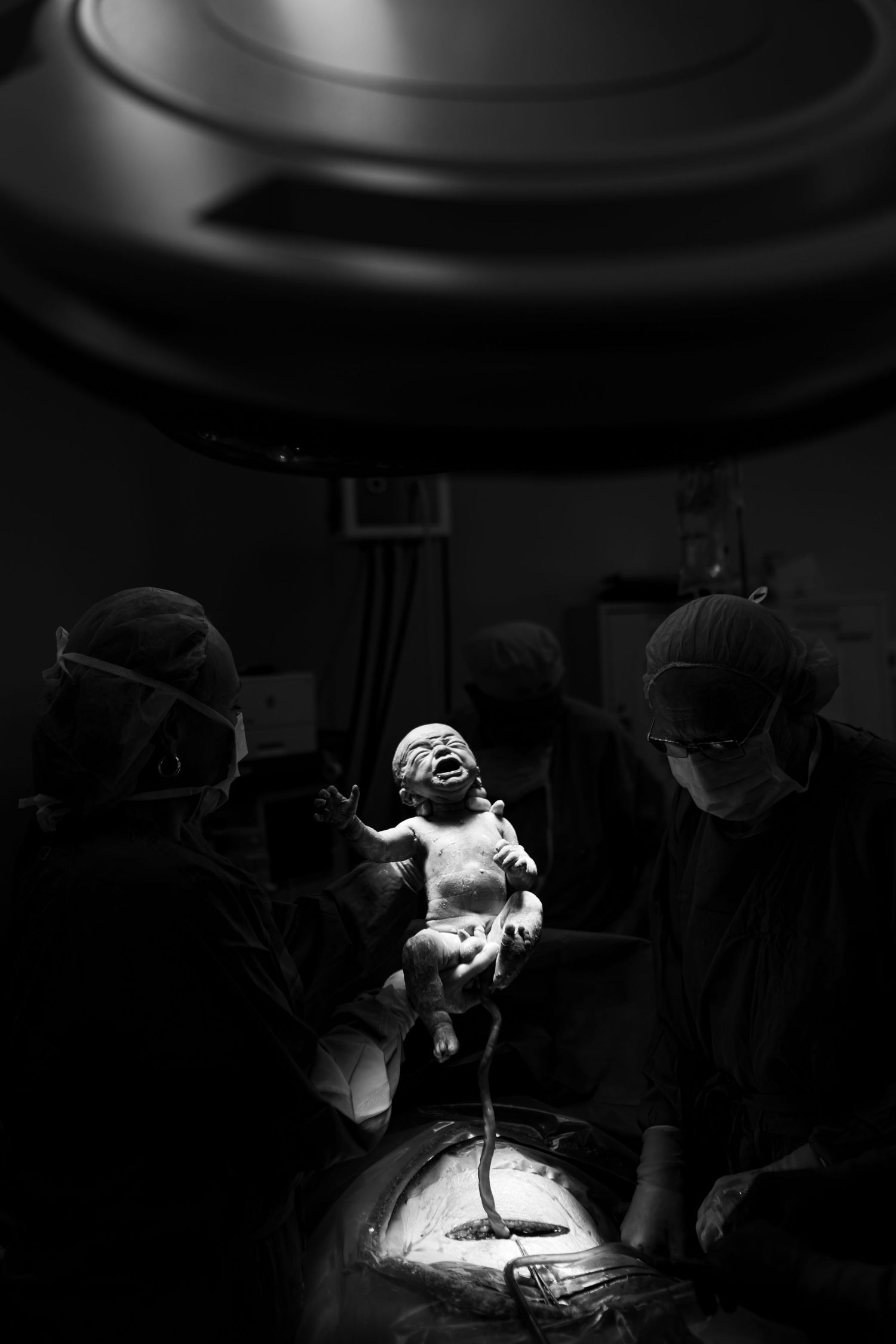 A series of black and white images showing surgical procedures being performed in a dimly lit operating room setting.