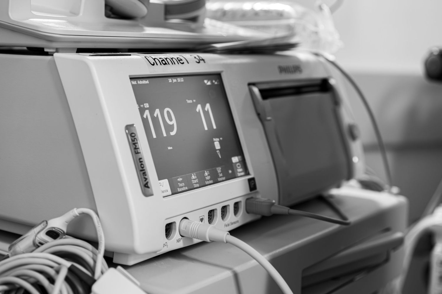 Contraction monitor in hospital