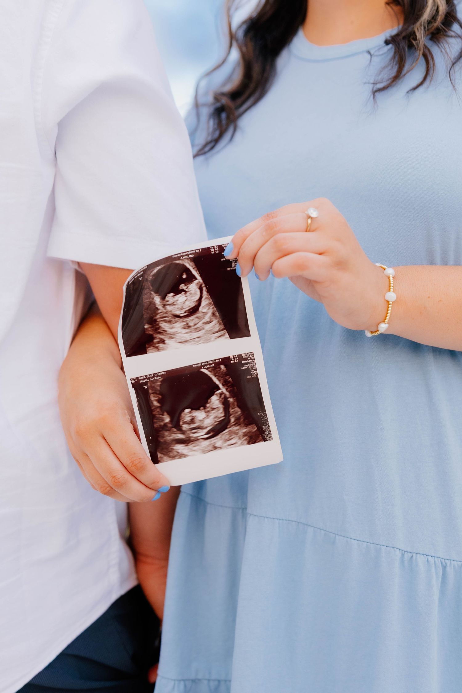 Couple holding ultrasound photos together, woman wearing blue dress and gold bracelet, pregnancy announcement photo.