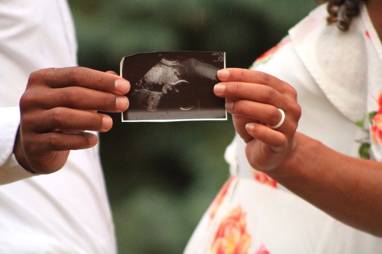 Hands holding up an ultrasound photograph against a blurred outdoor background.