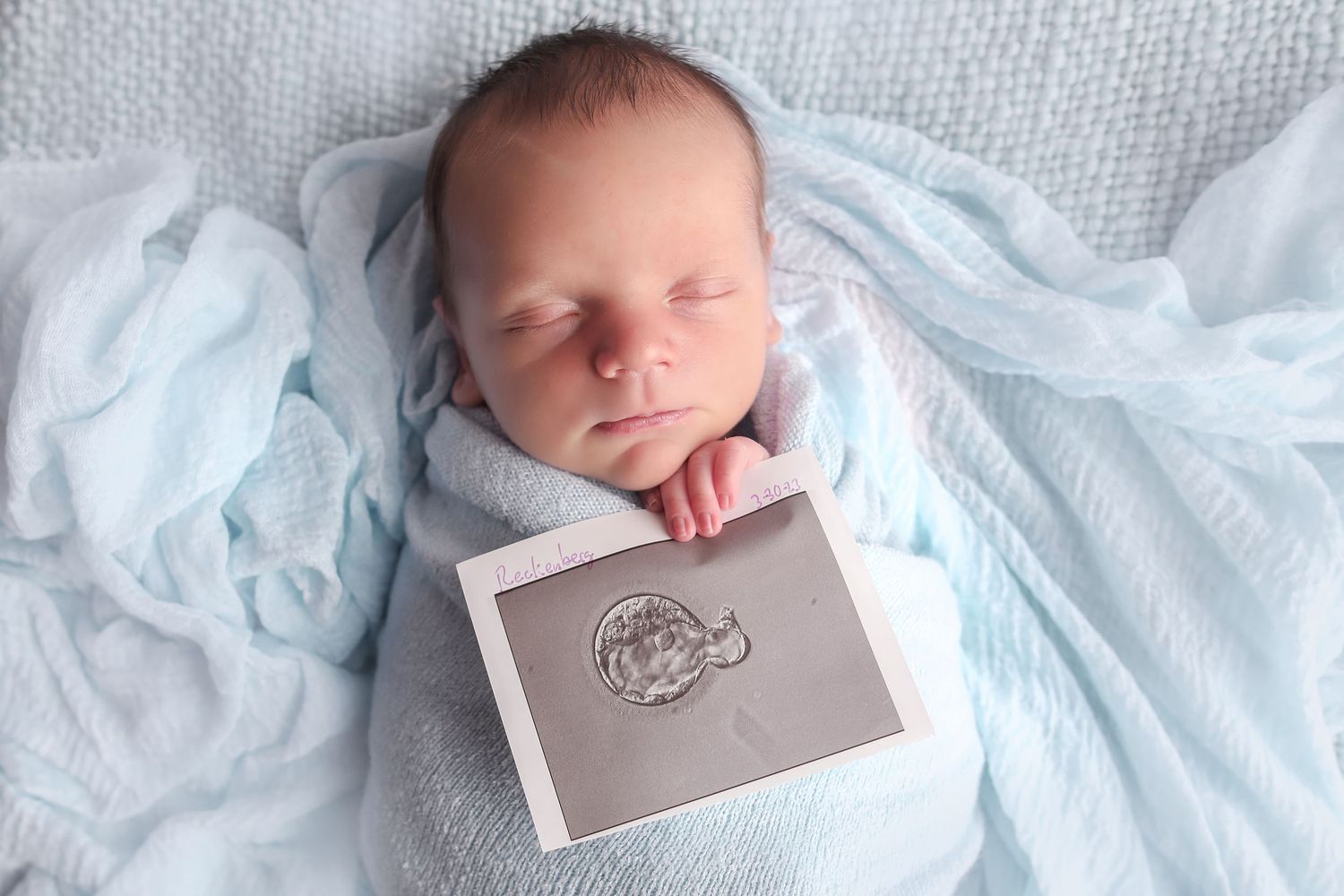 Sleeping newborn baby lying on blue blanket with ultrasound photo.
