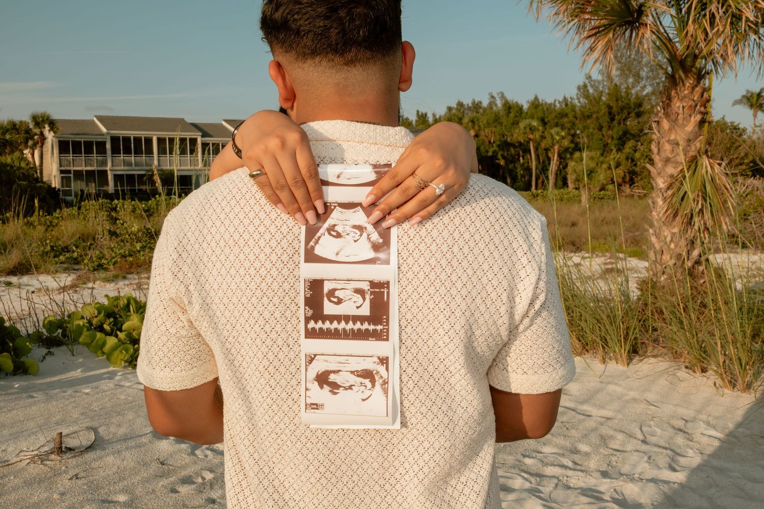 Man on beach holding ultrasound photos on his back, announcing pregnancy near palm trees and coastal homes.