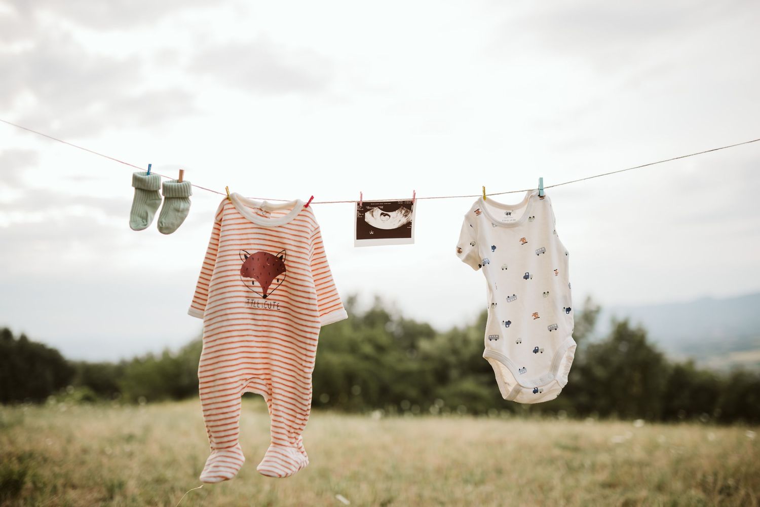 Baby clothes and socks hanging on a clothesline outdoors with a ultrasound photo in a green field.