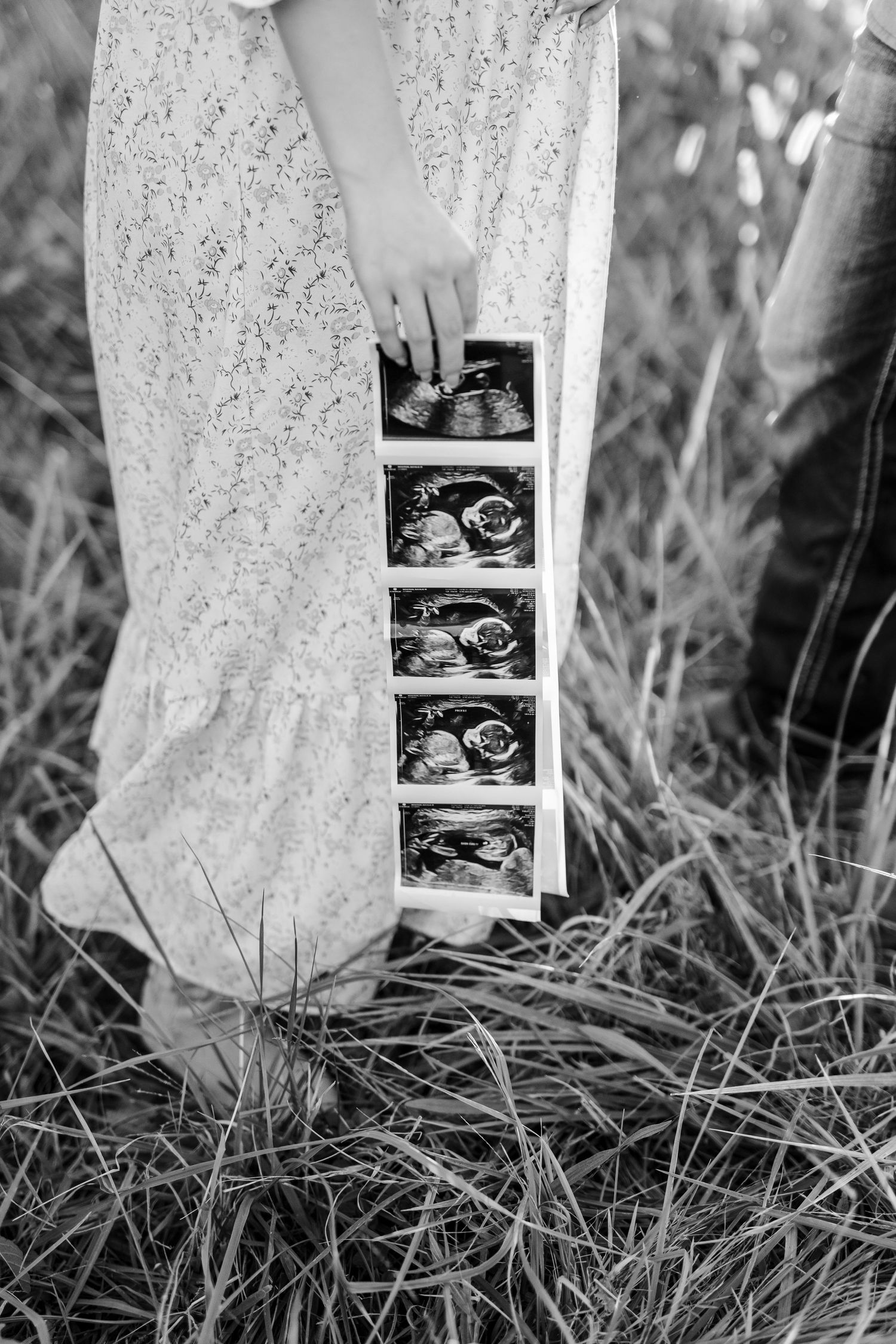 Close-up black and white photo of a pregnant woman in a lace dress holding ultrasound images in a grassy field.